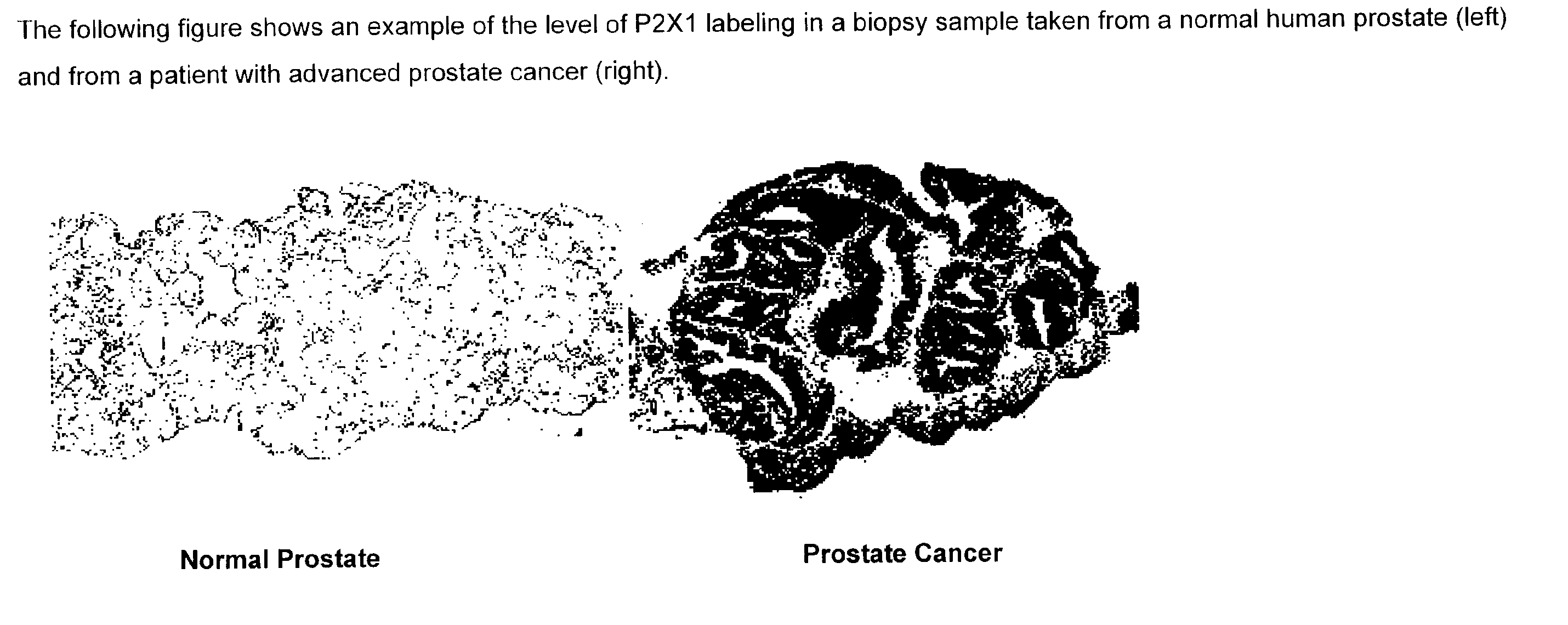 Method for identifying pre-neoplastic and/or neoplastic states in mammals