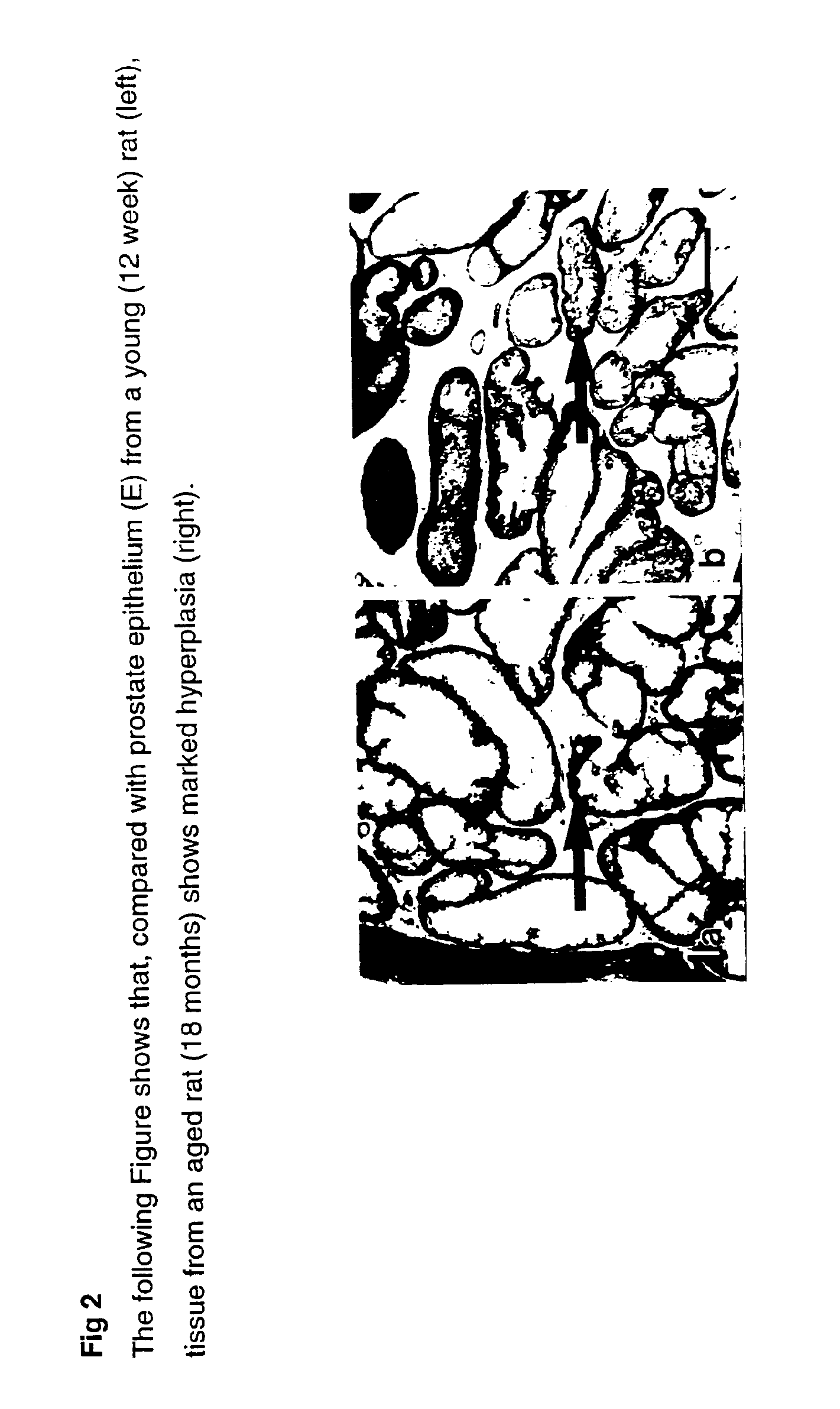 Method for identifying pre-neoplastic and/or neoplastic states in mammals