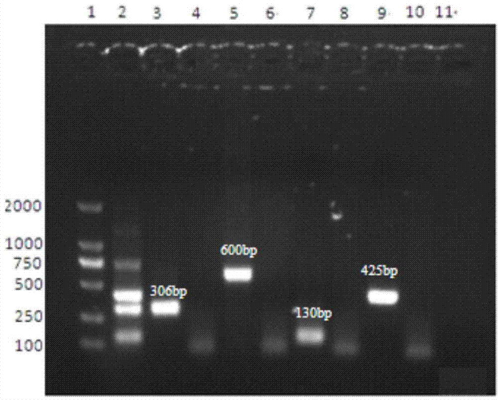 Multiplex-PCR (polymerase chain reaction) detection kit for bovine respiratory disease complex and preparation method thereof