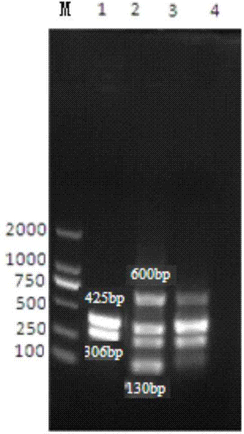 Multiplex-PCR (polymerase chain reaction) detection kit for bovine respiratory disease complex and preparation method thereof