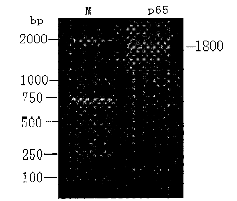 Construction and application of attenuated Salmonella choleraesuis for expressing mycoplasma hyopneumoniae p65 protein