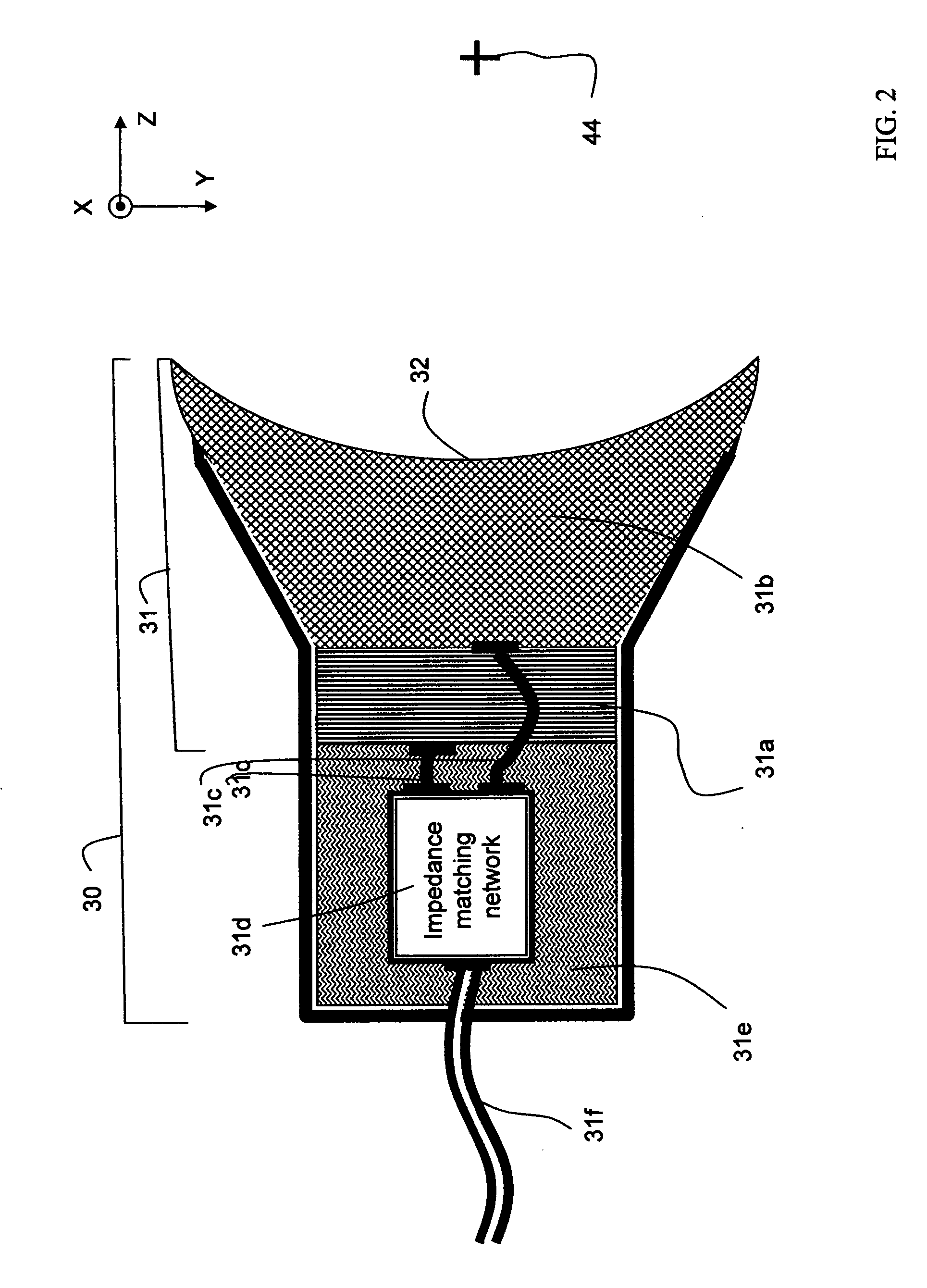 Intravascular ultrasound catheter device and method for ablating atheroma