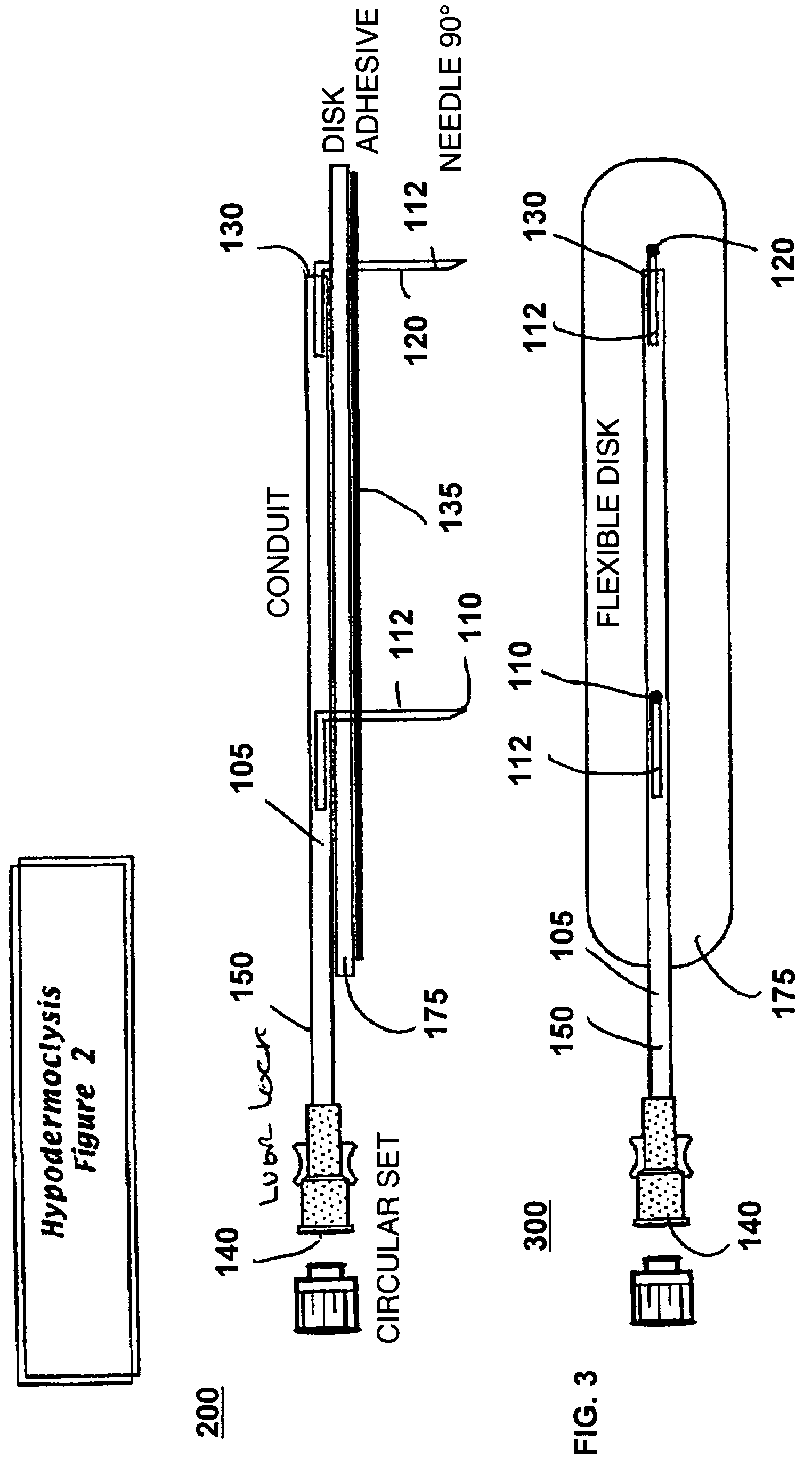 Device for subcutaneous infusion of fluids