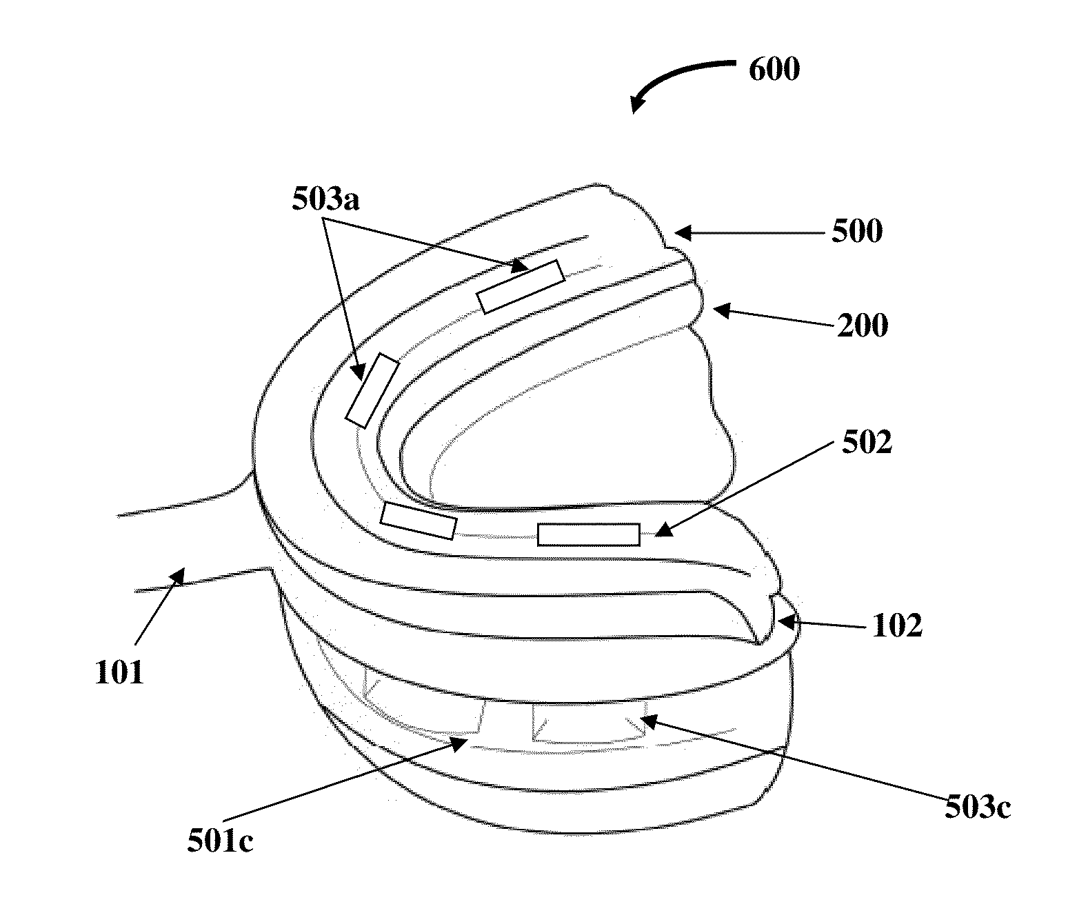 Determination Of A Three Dimensional Relation Between Upper and Lower Jaws With Reference To A Temporomandibular Joint