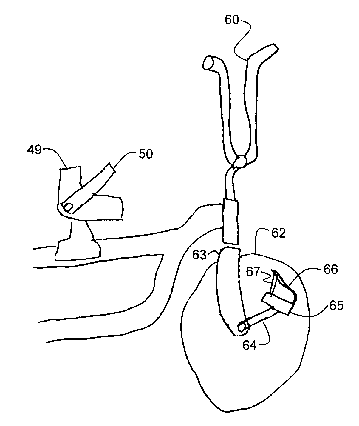 Riding apparatus for disabled persons and kit for making same