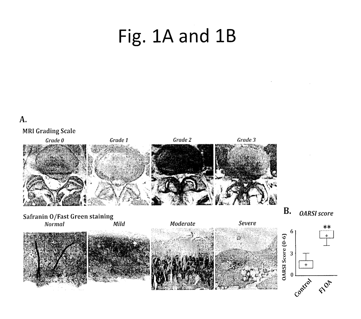 Mirna biomarkers for cartilage degeneration