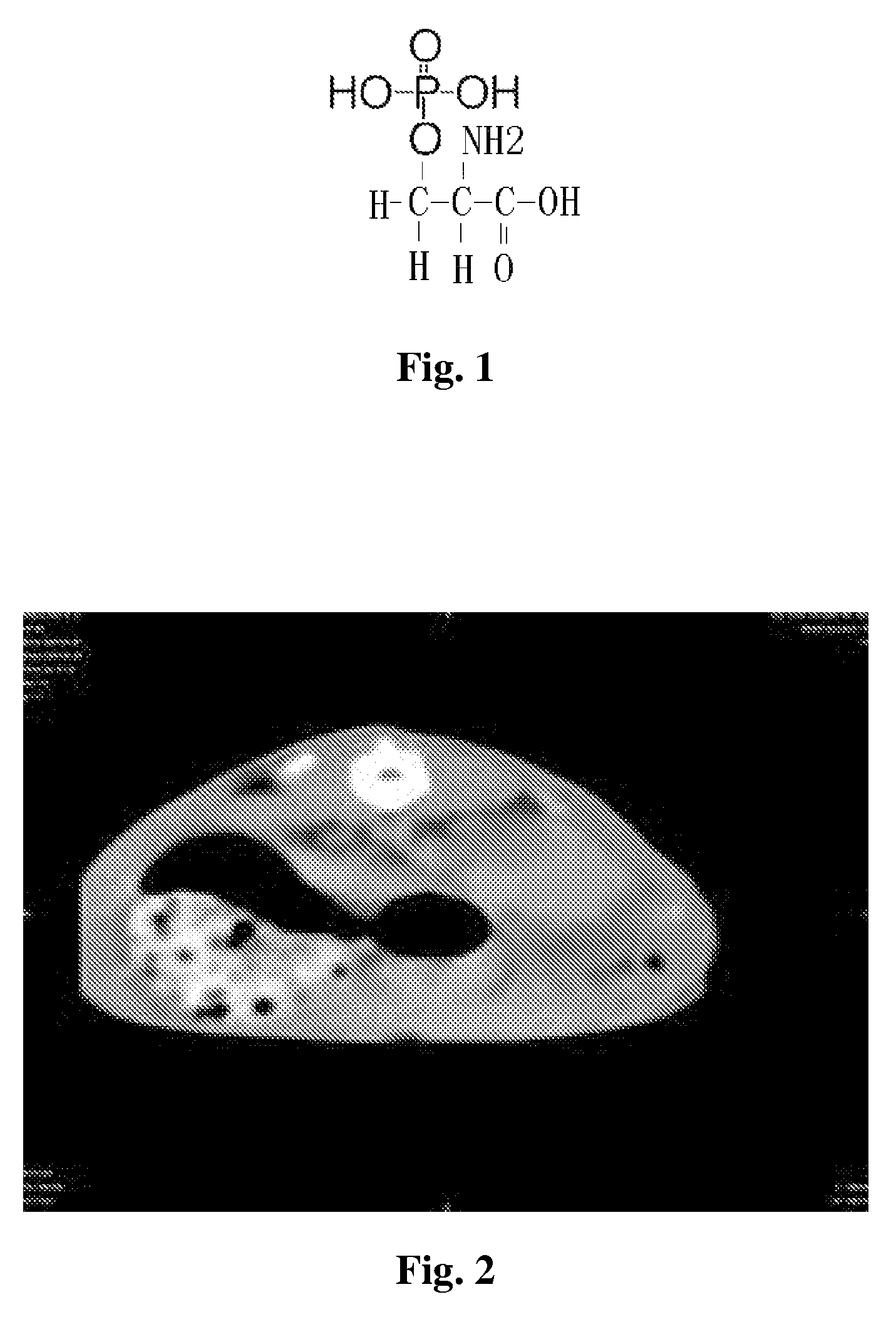 Bioactive peptide of bone morphogenetic protein-2