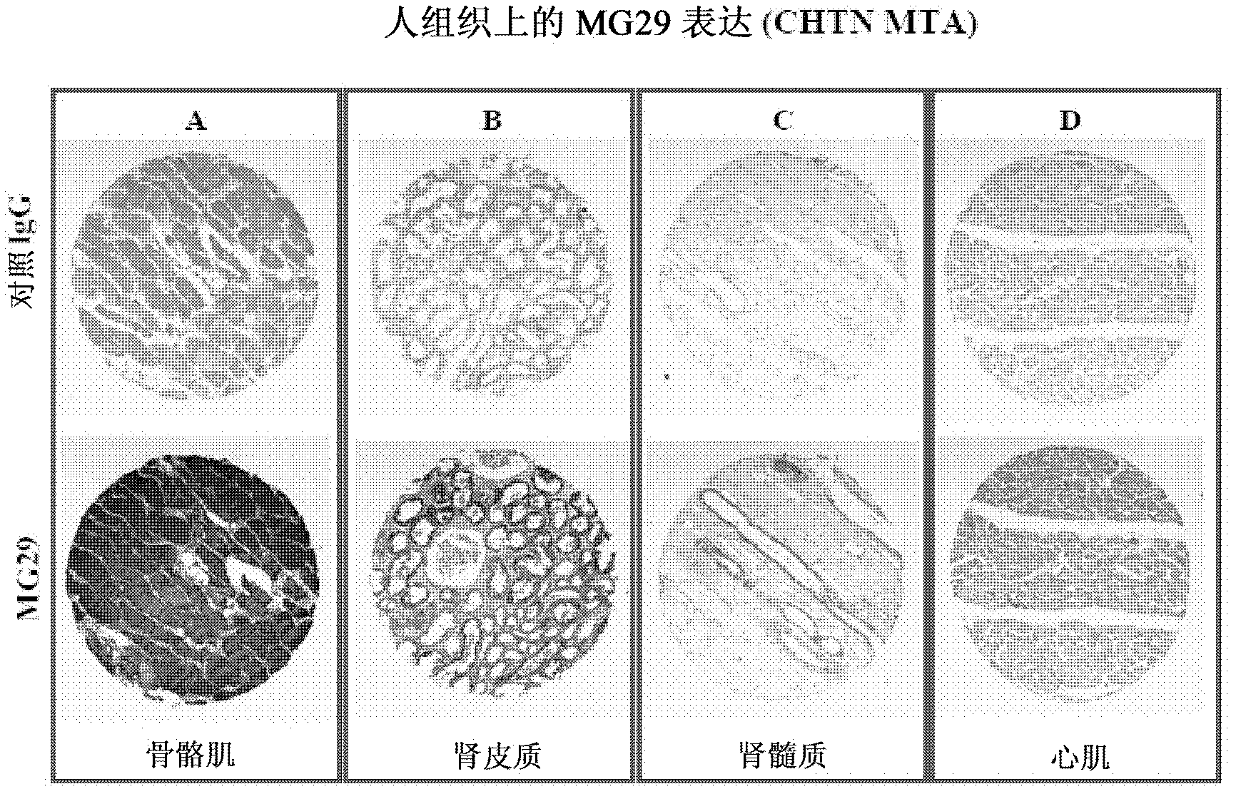 Compositions And Methods Modulating Mg29 For The Treatment Of Diabetes