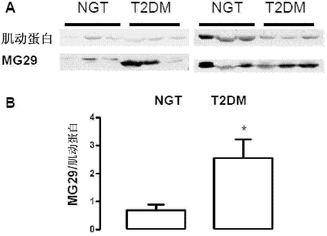 Compositions And Methods Modulating Mg29 For The Treatment Of Diabetes