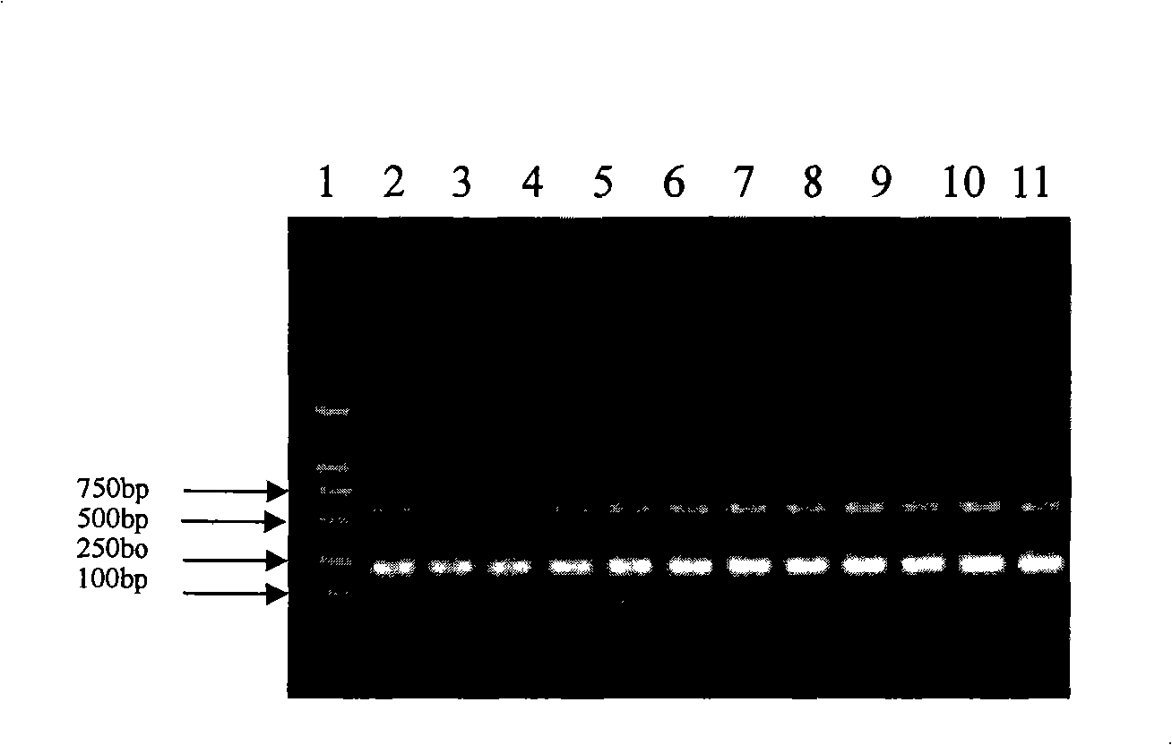 Multiplex RT-PCR method for diagnosing equine influenza virus and identifying subtype thereof