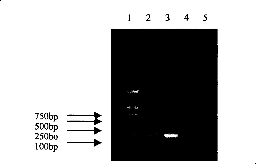 Multiplex RT-PCR method for diagnosing equine influenza virus and identifying subtype thereof