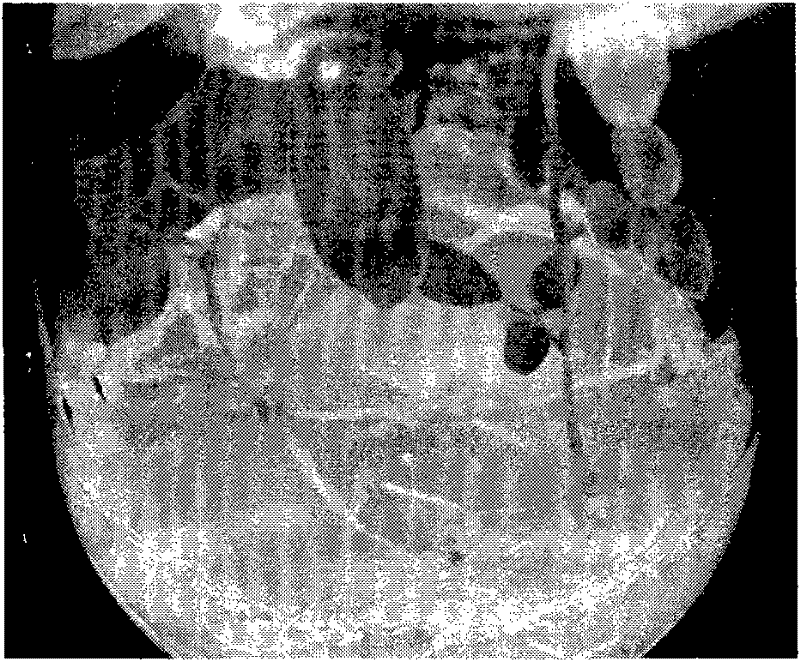 Vacuum-infiltration assisted exogenous gene transforming method of soybean germinating embryo