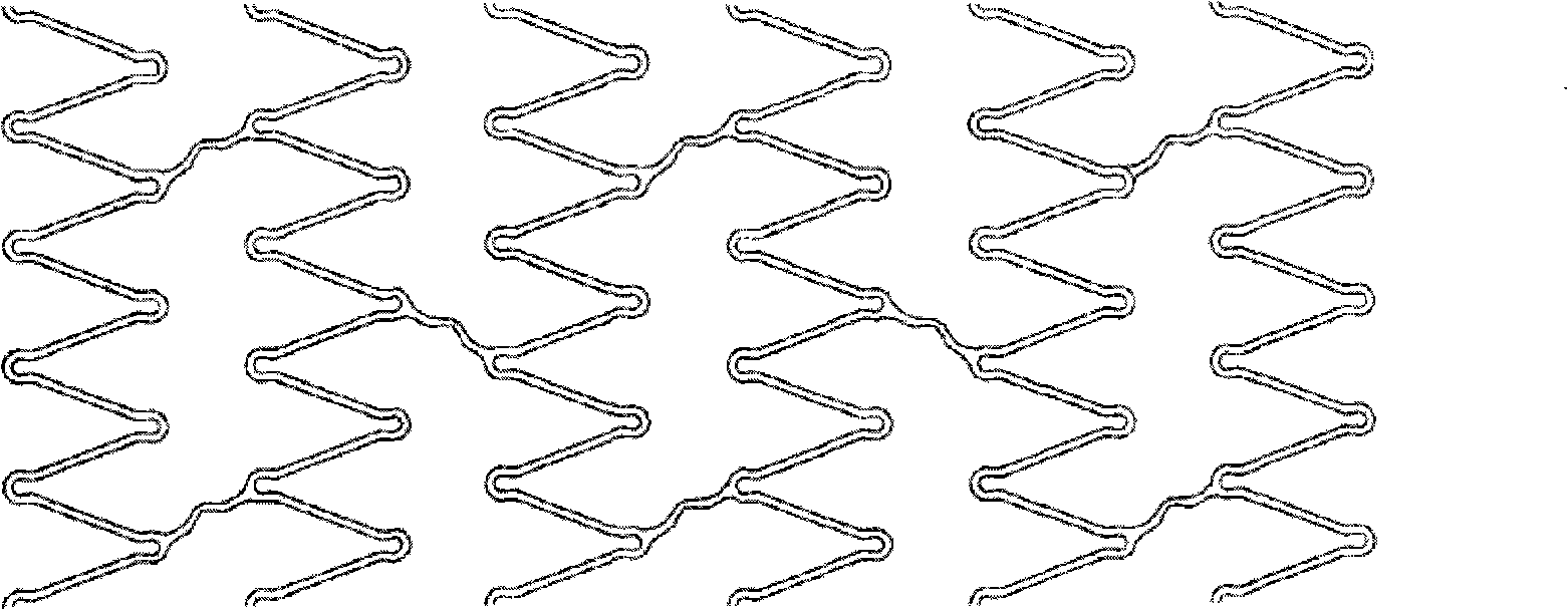 Self-expanding medicament stent and preparation method thereof