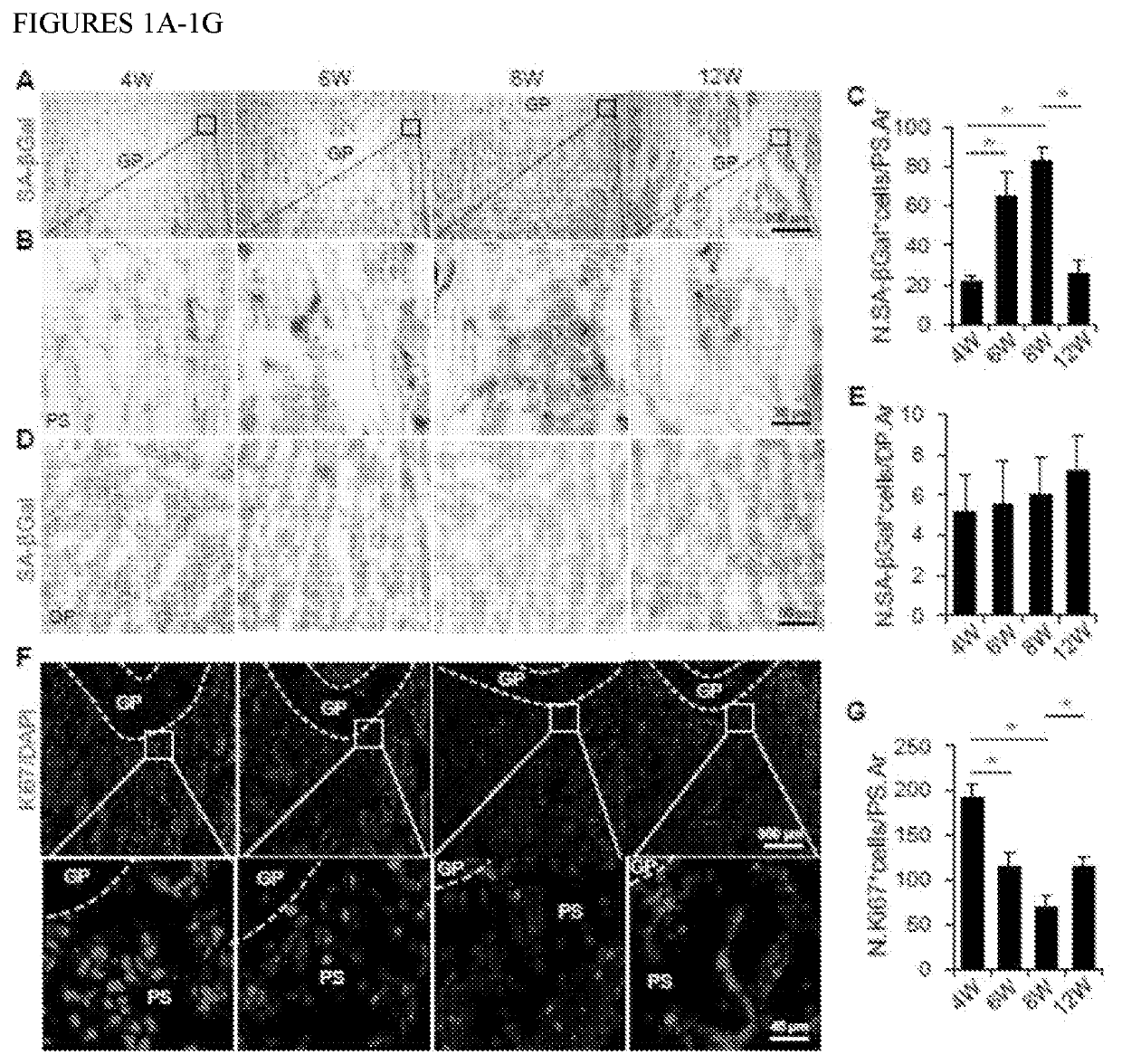 H3k27 demethylase inhibitors in pediatric and juvenile osteoporosis