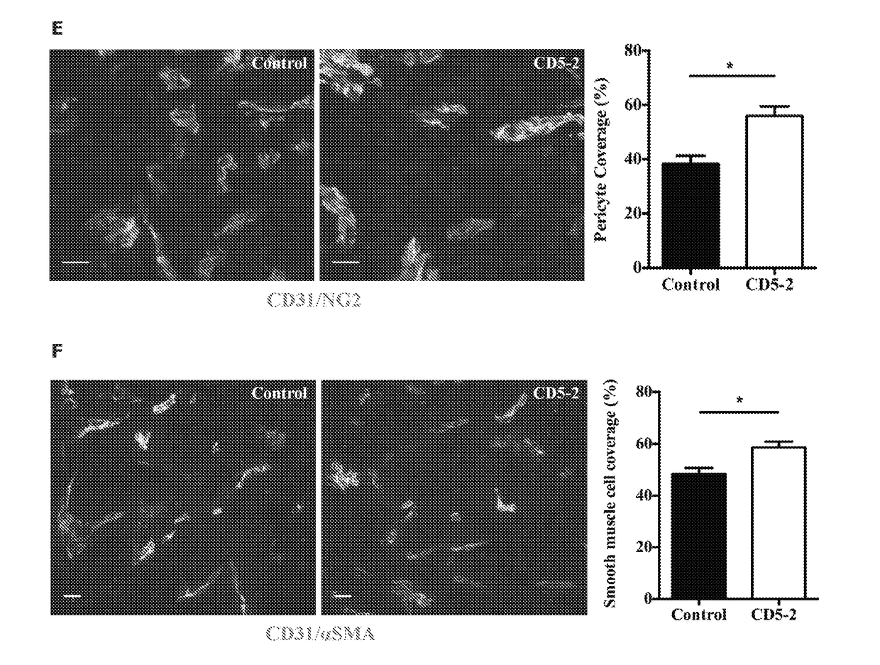 Methods for treating tumors