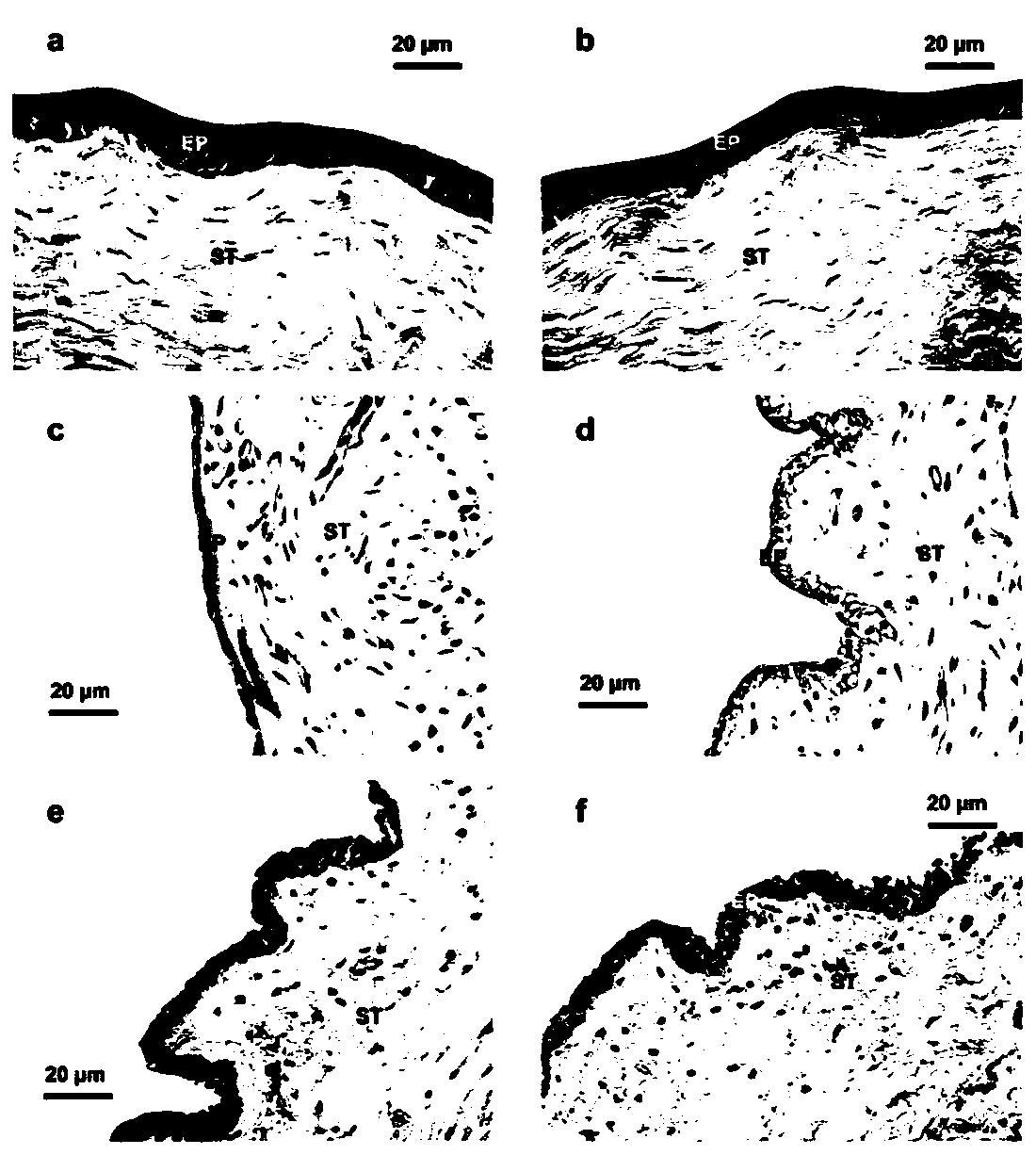 N-trimethyl chitosan modified baicalein ophthalmic lipid nanoparticle preparation and preparation method thereof