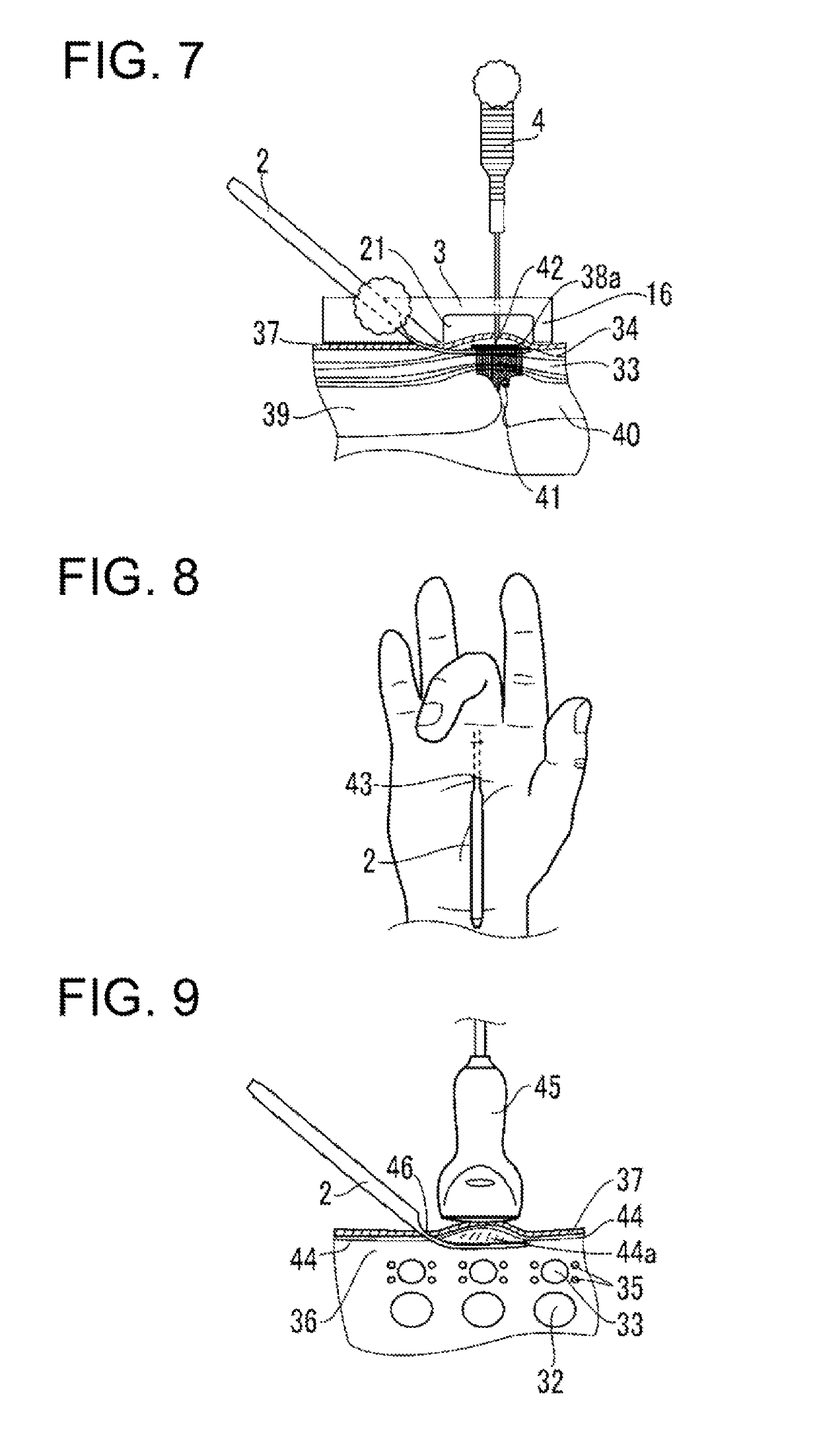 Surgical instrument for making incisions