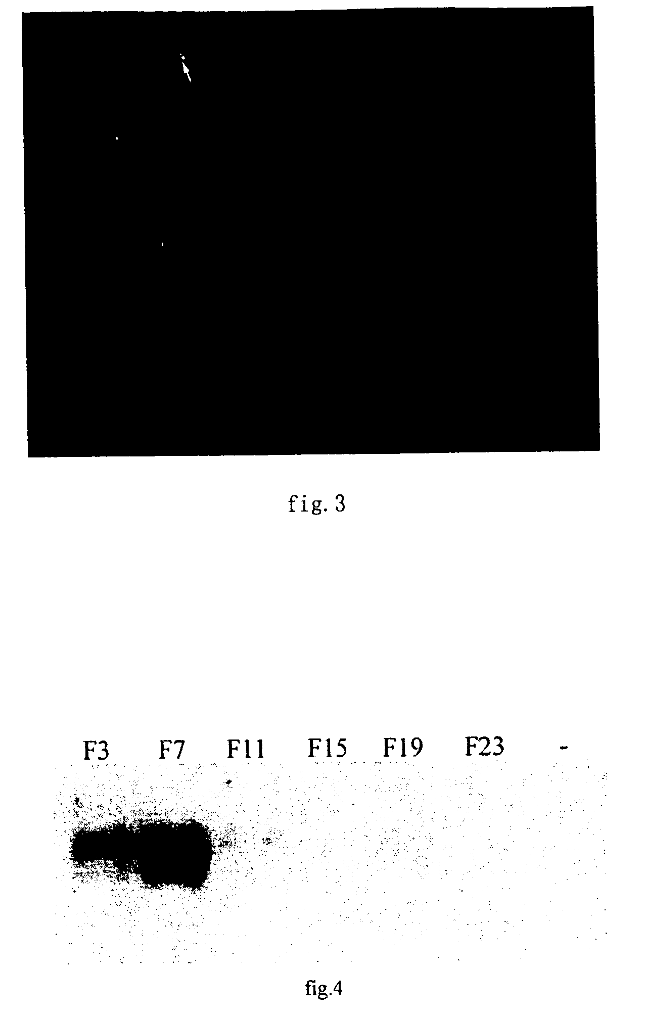 Novel gene therapy agent for haemophilia b and its preparation method