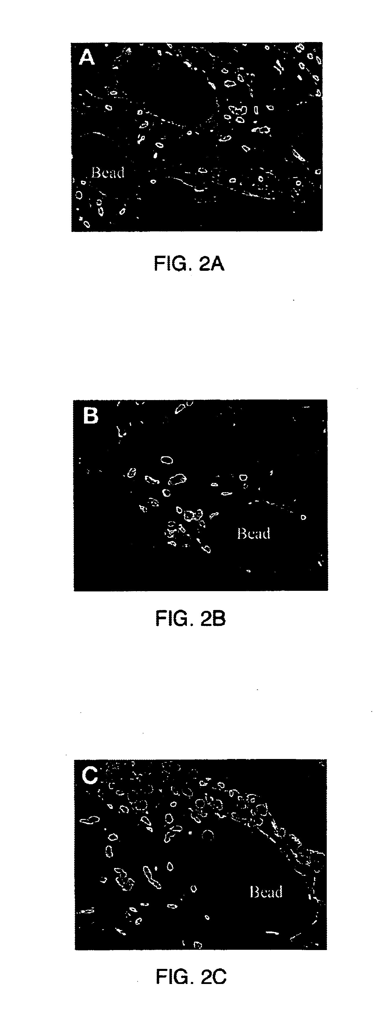 Long-term three dimensional tissue culture system