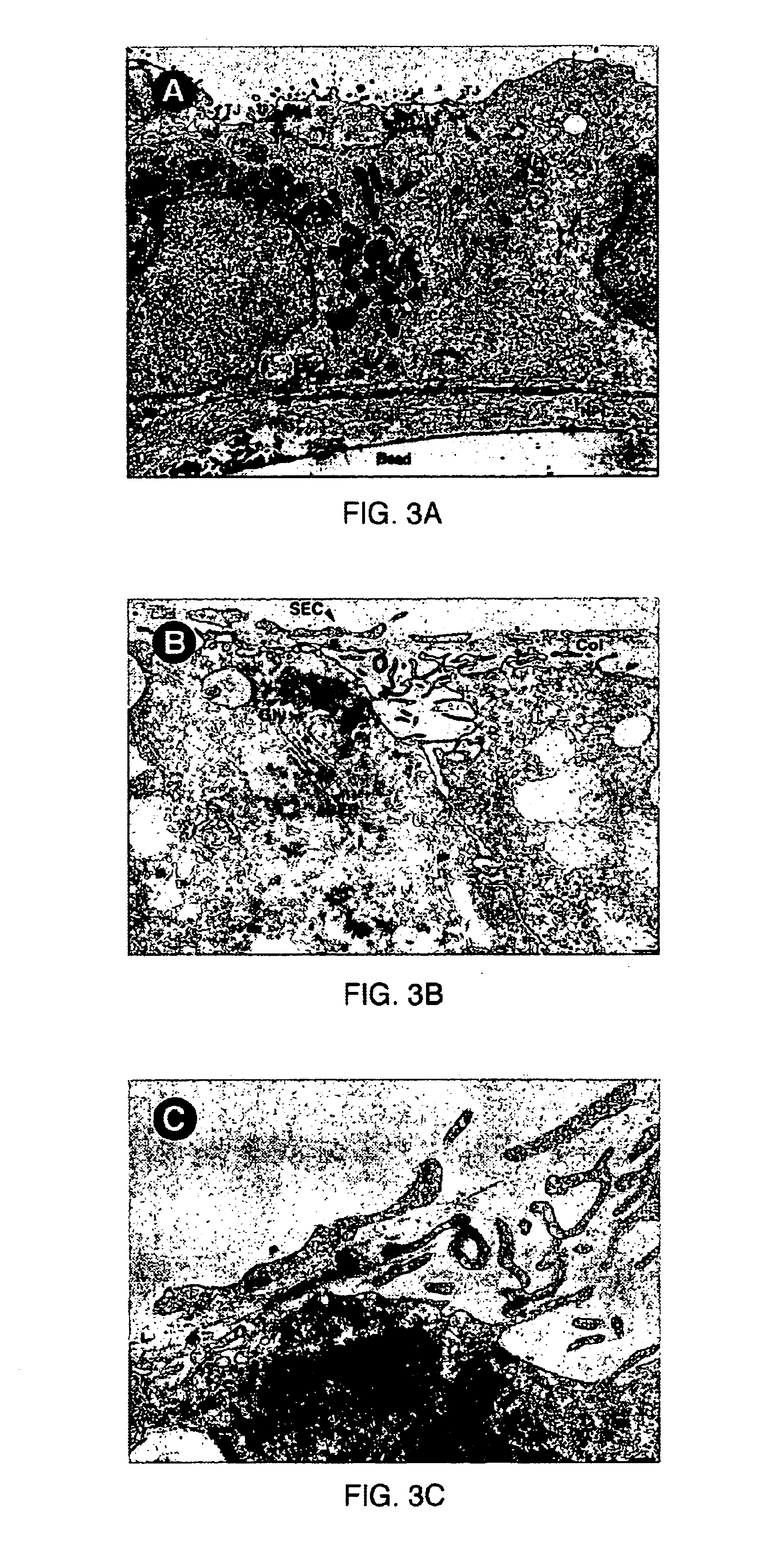 Long-term three dimensional tissue culture system