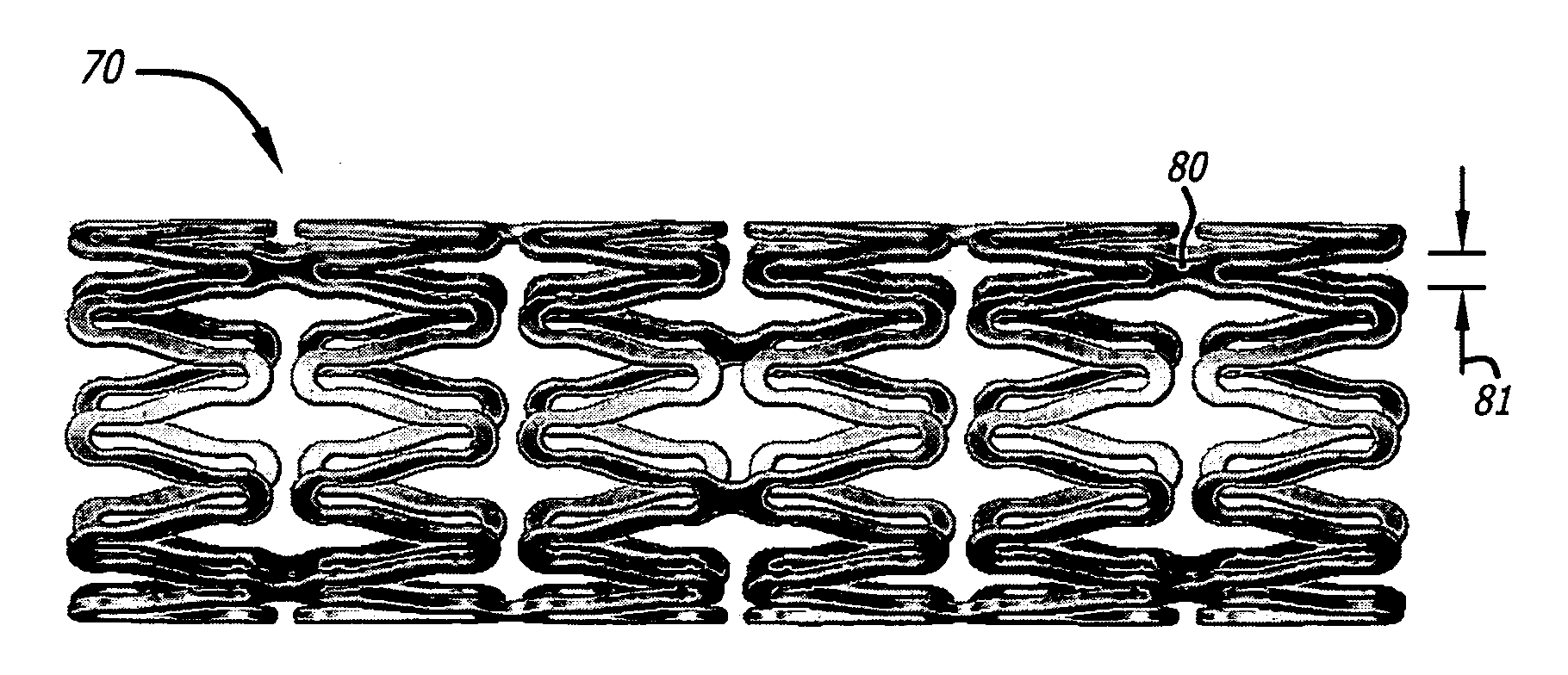 Implantable and lumen-supporting stents and related methods of manufacture and use