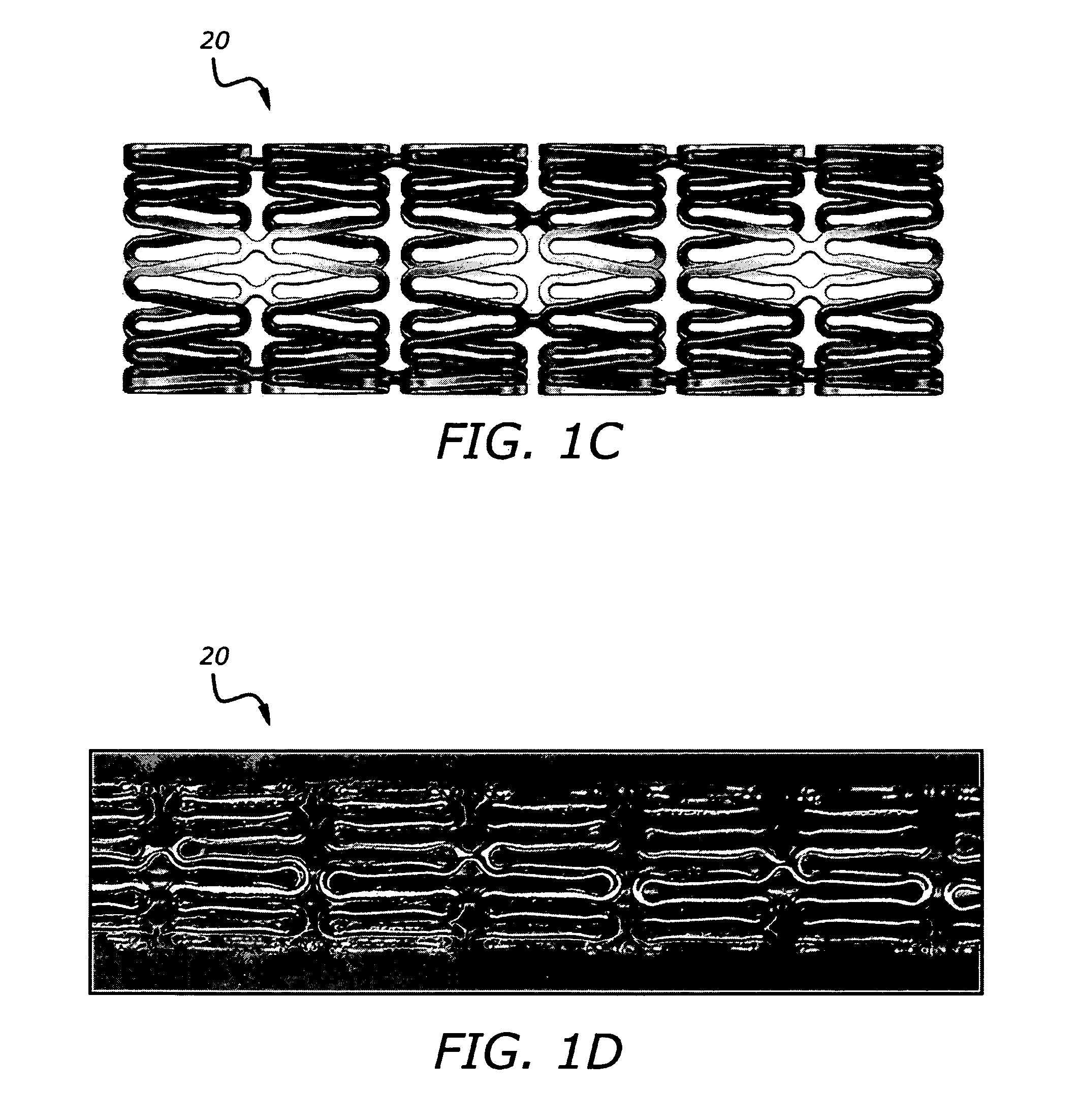 Implantable and lumen-supporting stents and related methods of manufacture and use