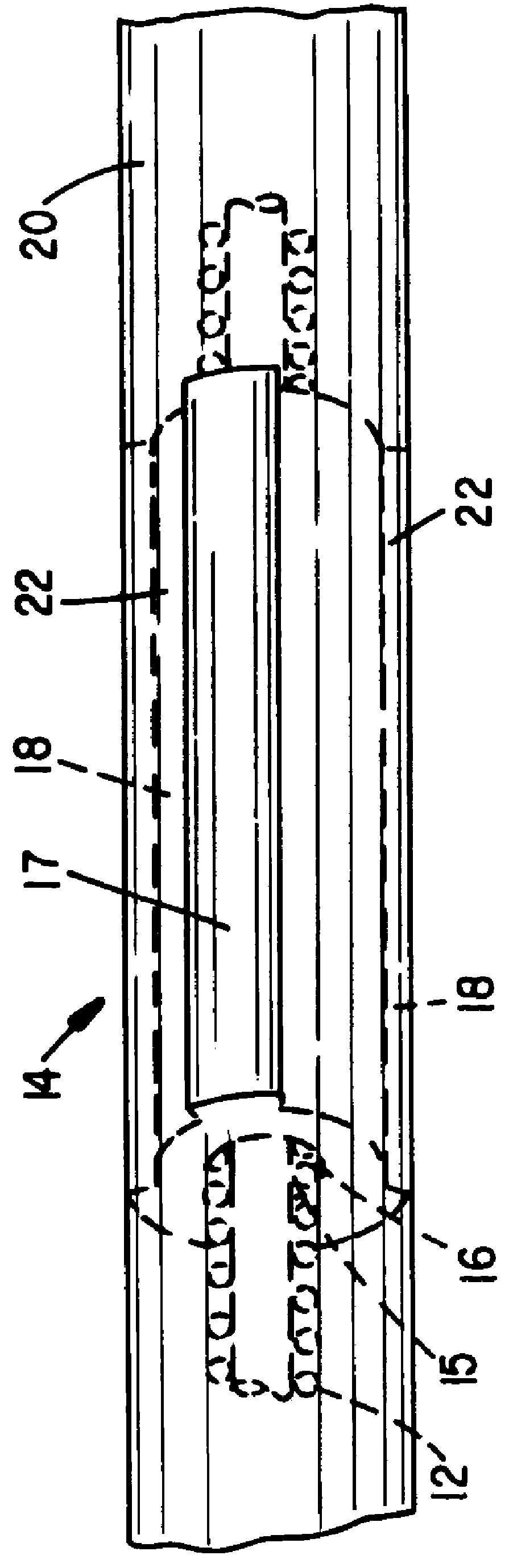 Slotted pacing/shocking electrode