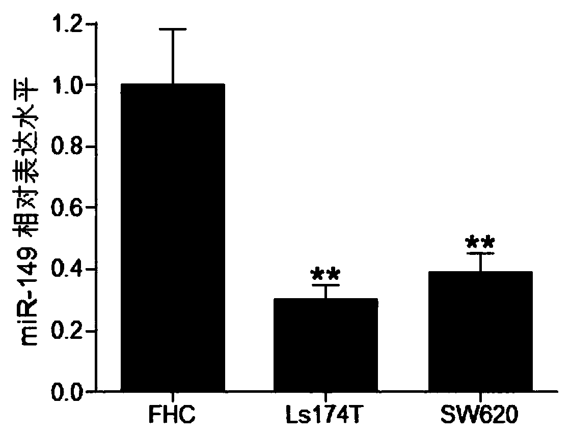 Application of microRNA and target gene thereof in colorectal cancer