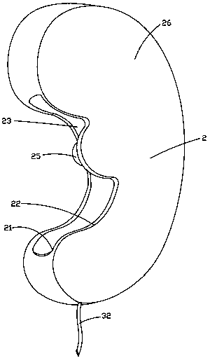 Ear massaging instrument for tinnitus rehabilitation treatment