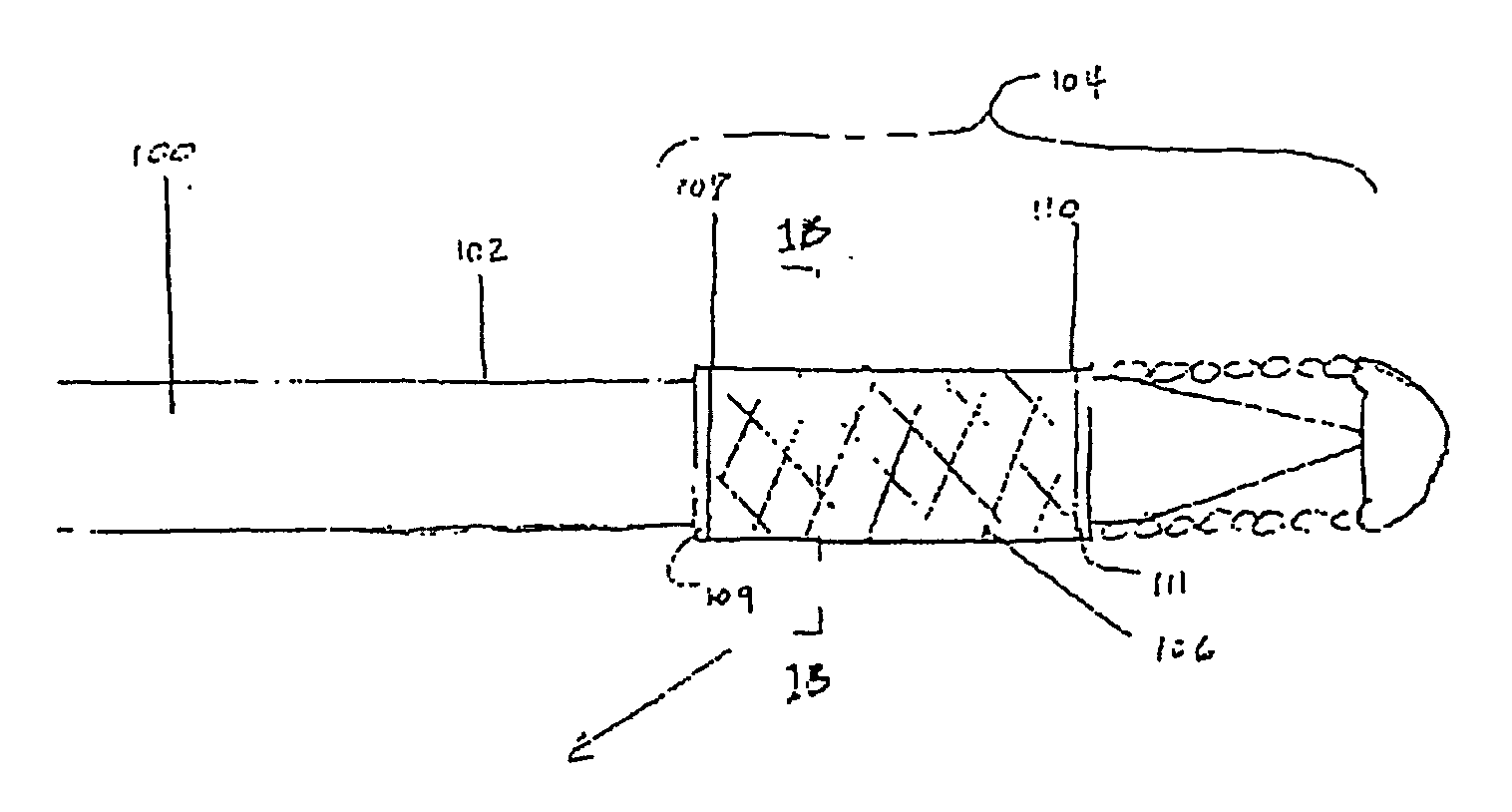 Implant delivery technologies