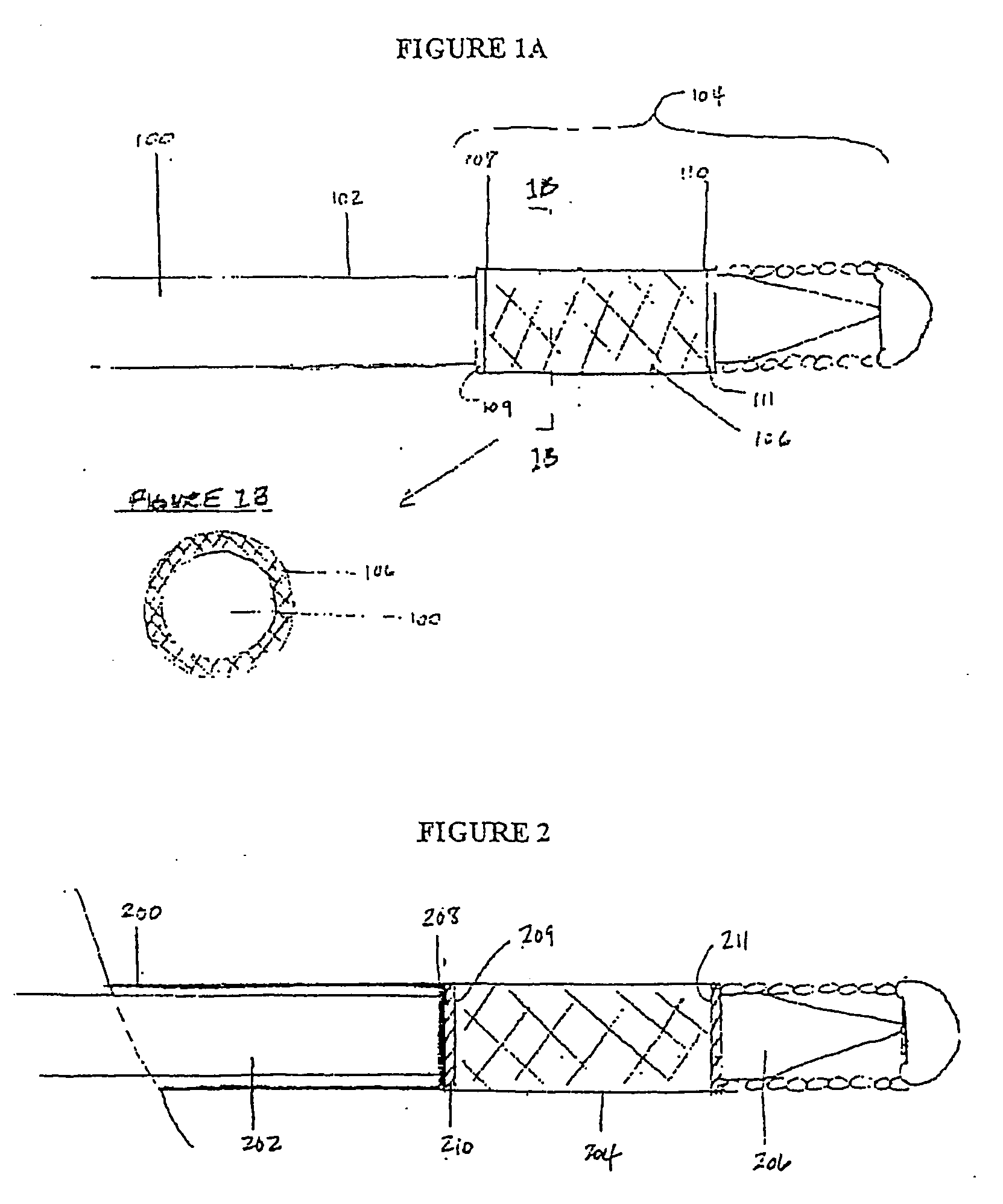 Implant delivery technologies