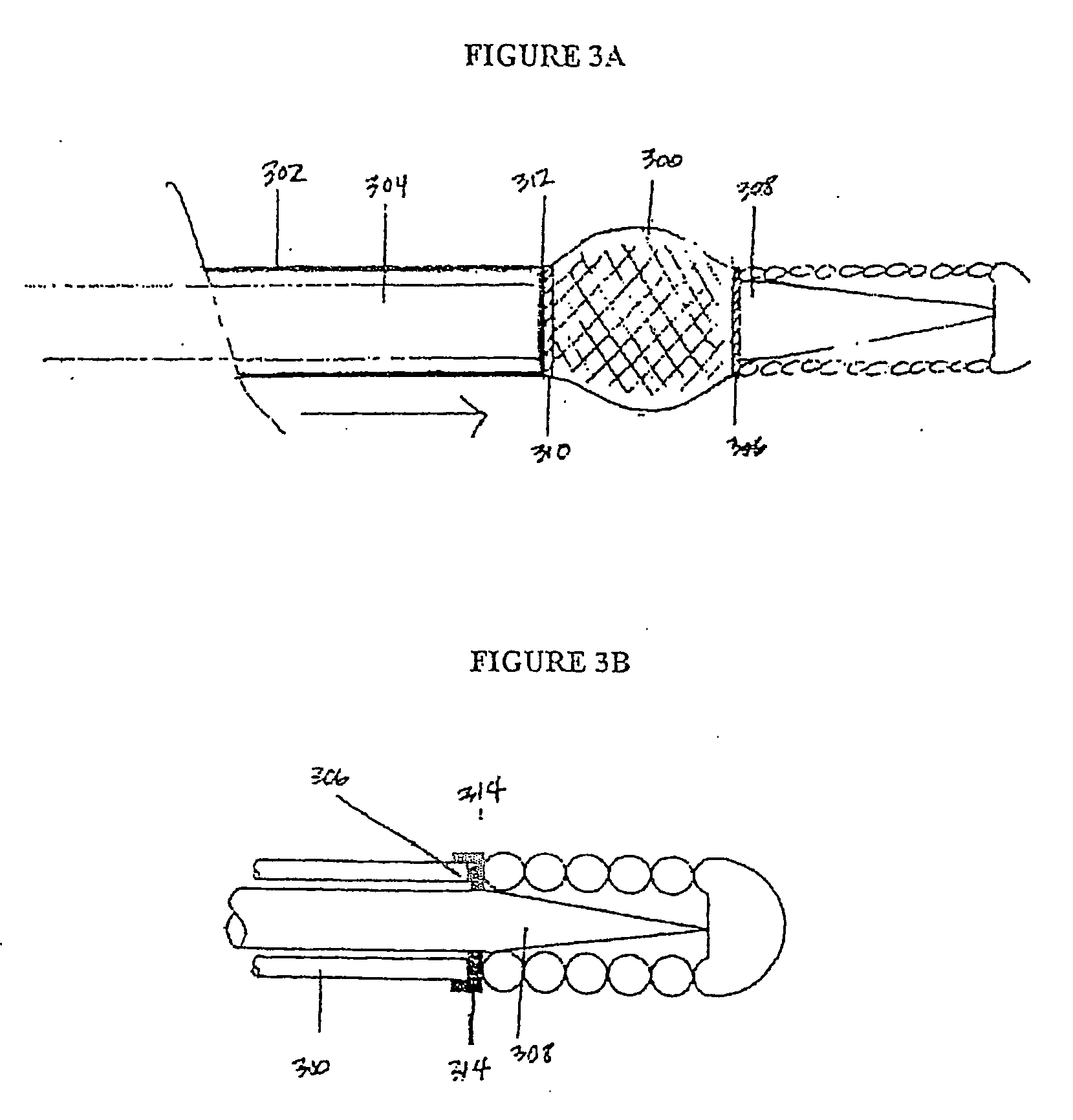 Implant delivery technologies