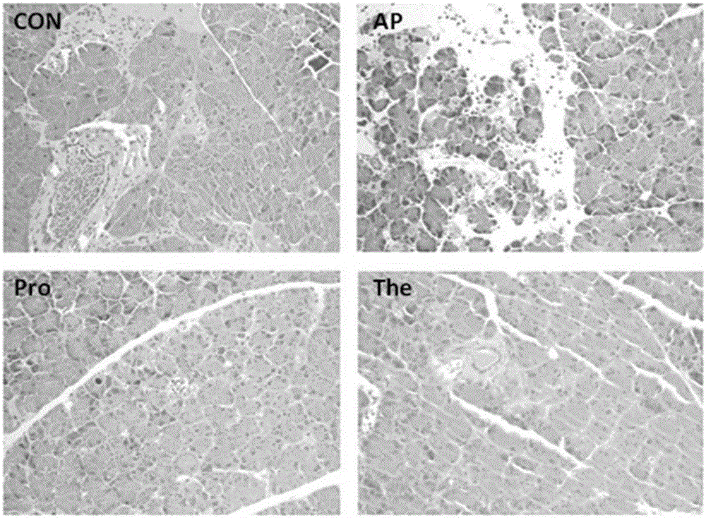 Application of alpha-lactose for preparing health care foods capable of preventing and treating acute pancreatitis