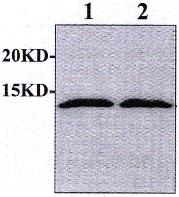 Preparation and application of apolipoprotein C-III monoclonal antibody