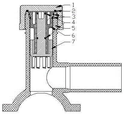 A Saddle-type Bypass of Rear Cloth Electrofusion