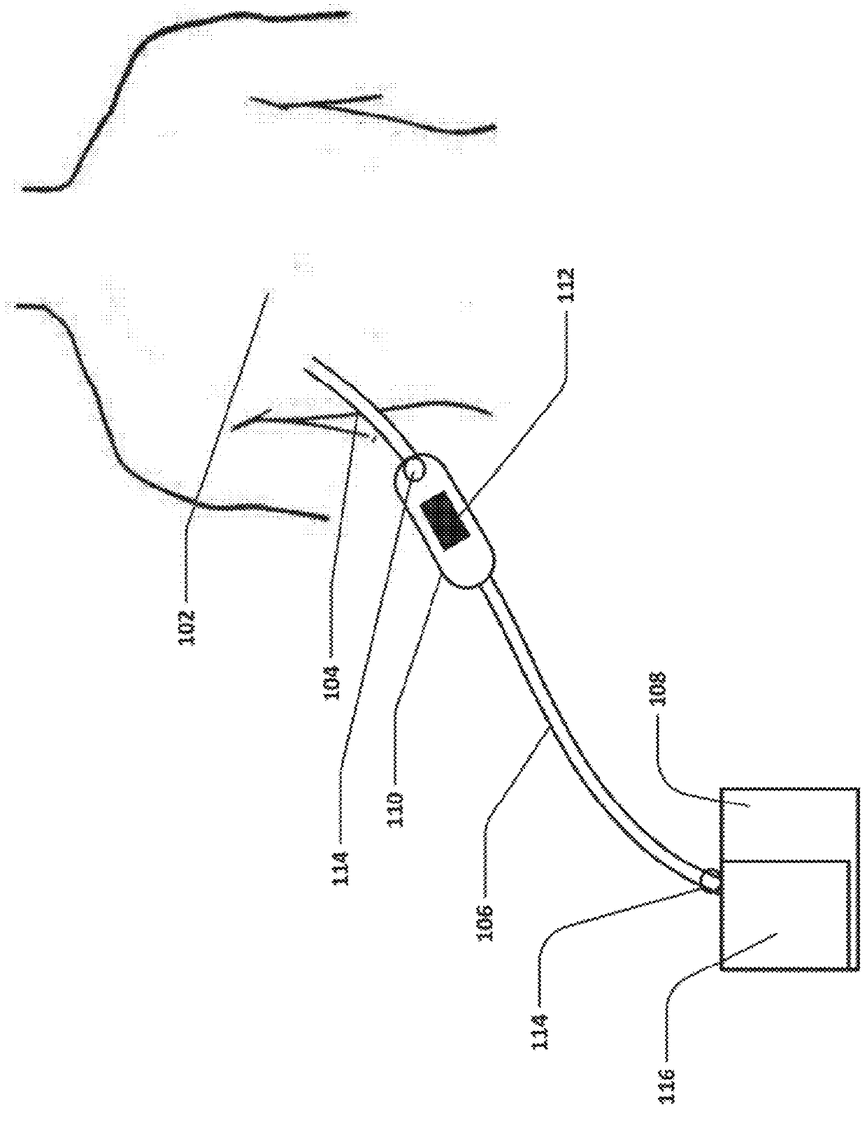 Devices and methods for managing chest drainage