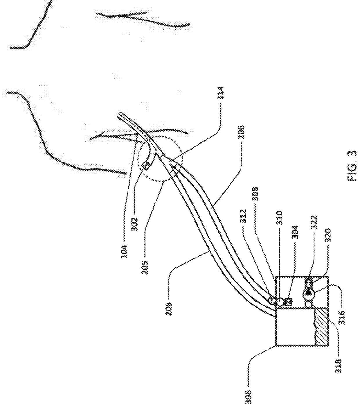 Devices and methods for managing chest drainage