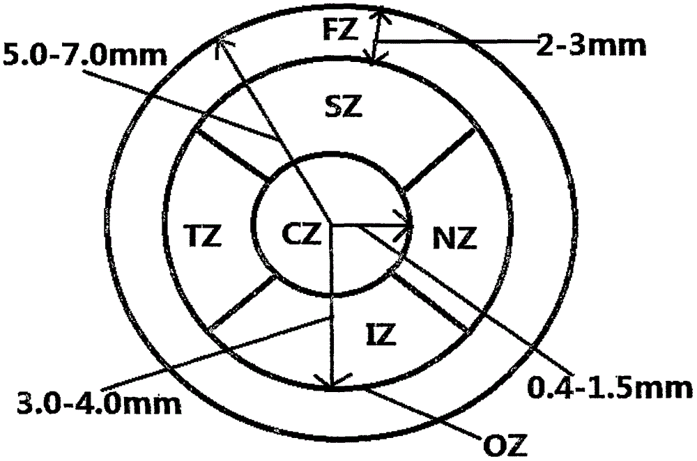 Four-quadrant area ambitus out-of-focus corneal contact lens