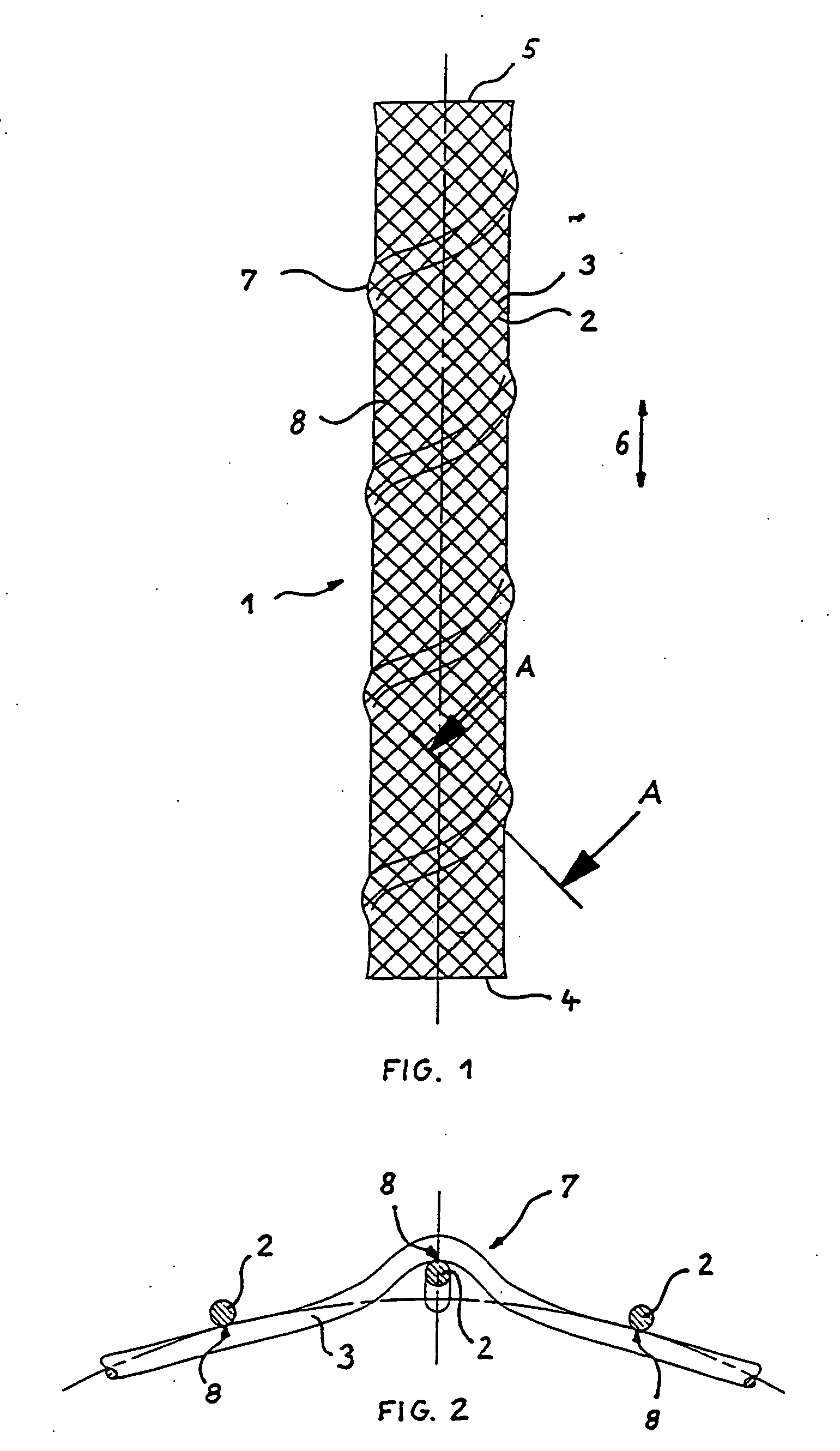 Braided stent