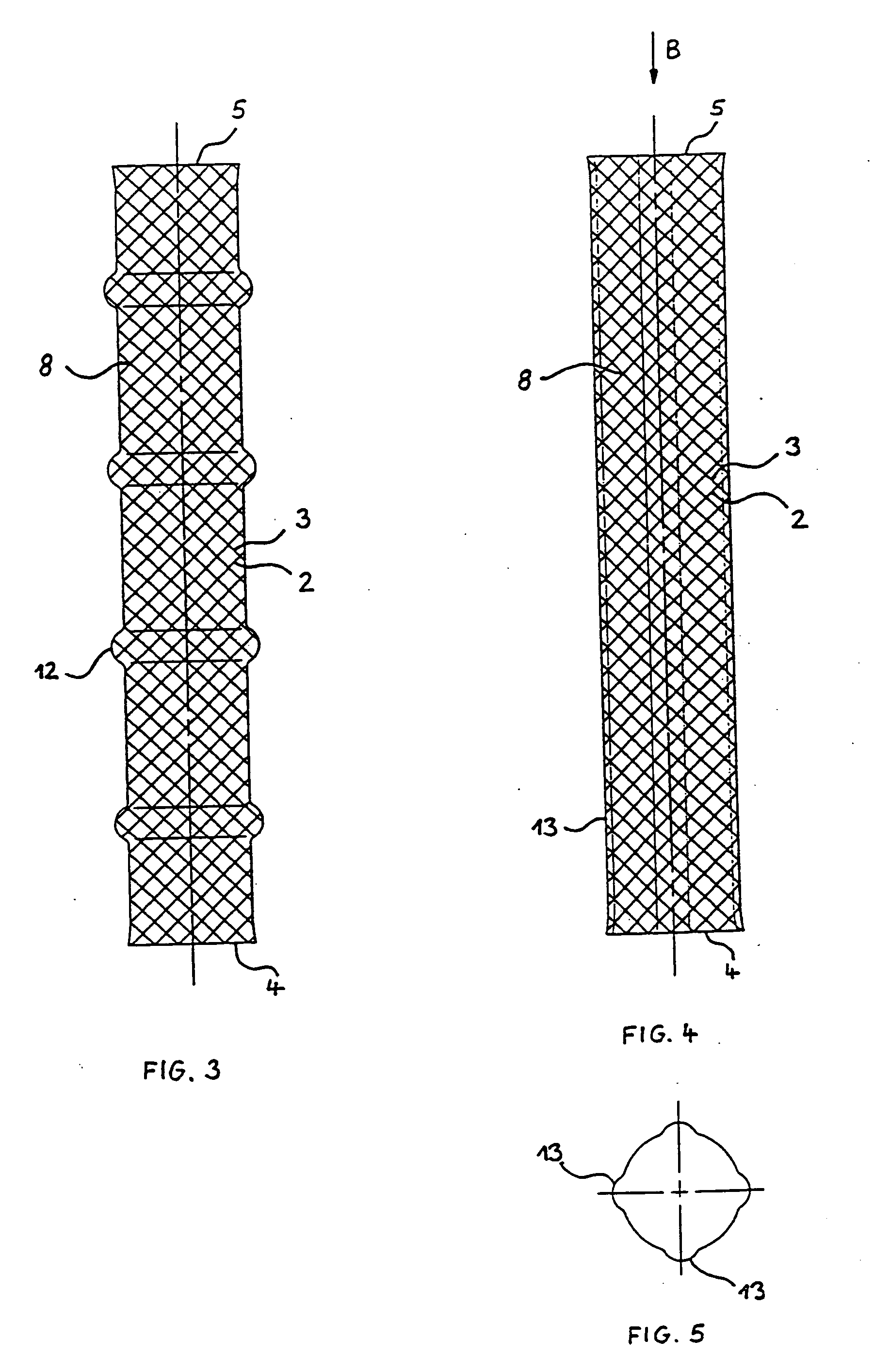 Braided stent