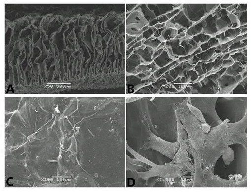 Ultrathin I/II type collagen composite scaffold and preparation method thereof