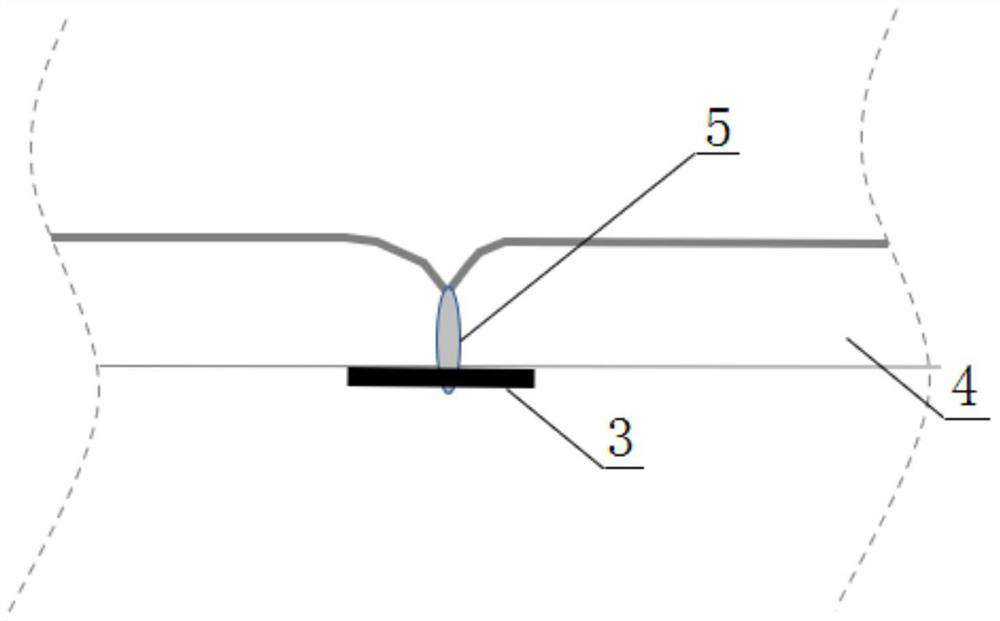 Three-dimensional skin sewing method