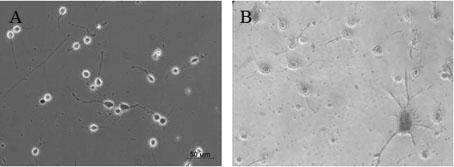 2-acetylaloeemodin and preparation method and application thereof