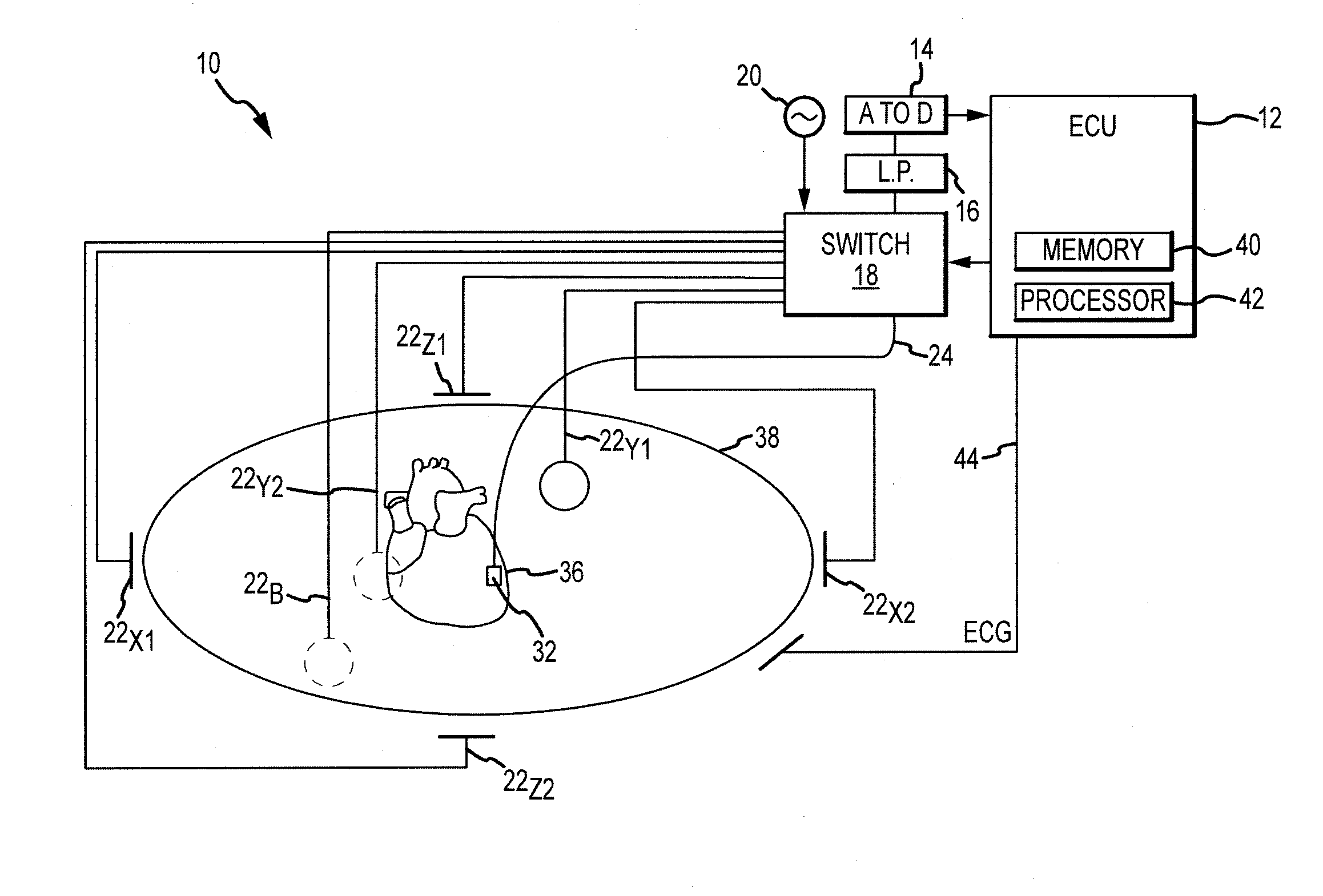 Regularization schemes for non-contact mapping with a medical device