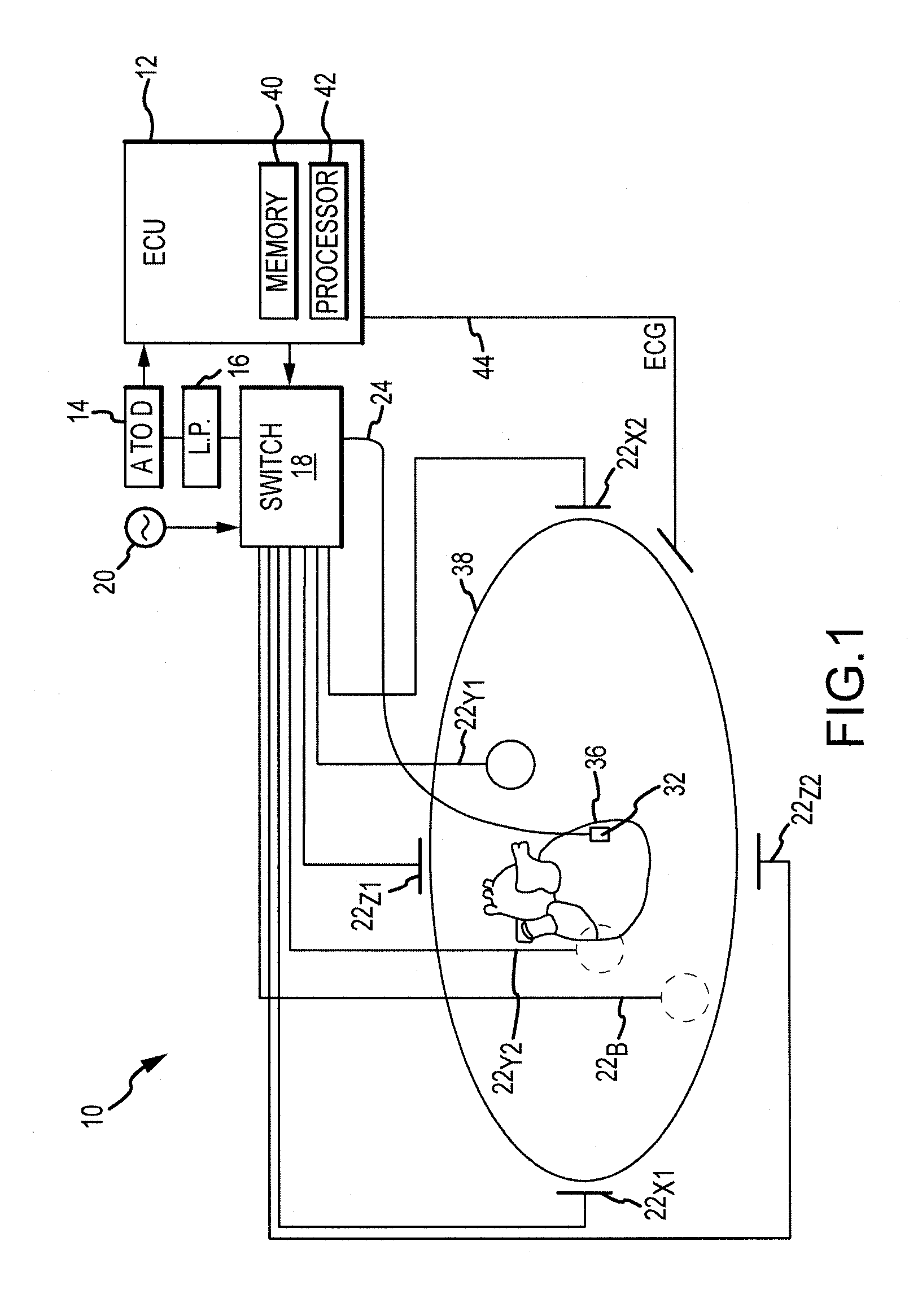 Regularization schemes for non-contact mapping with a medical device