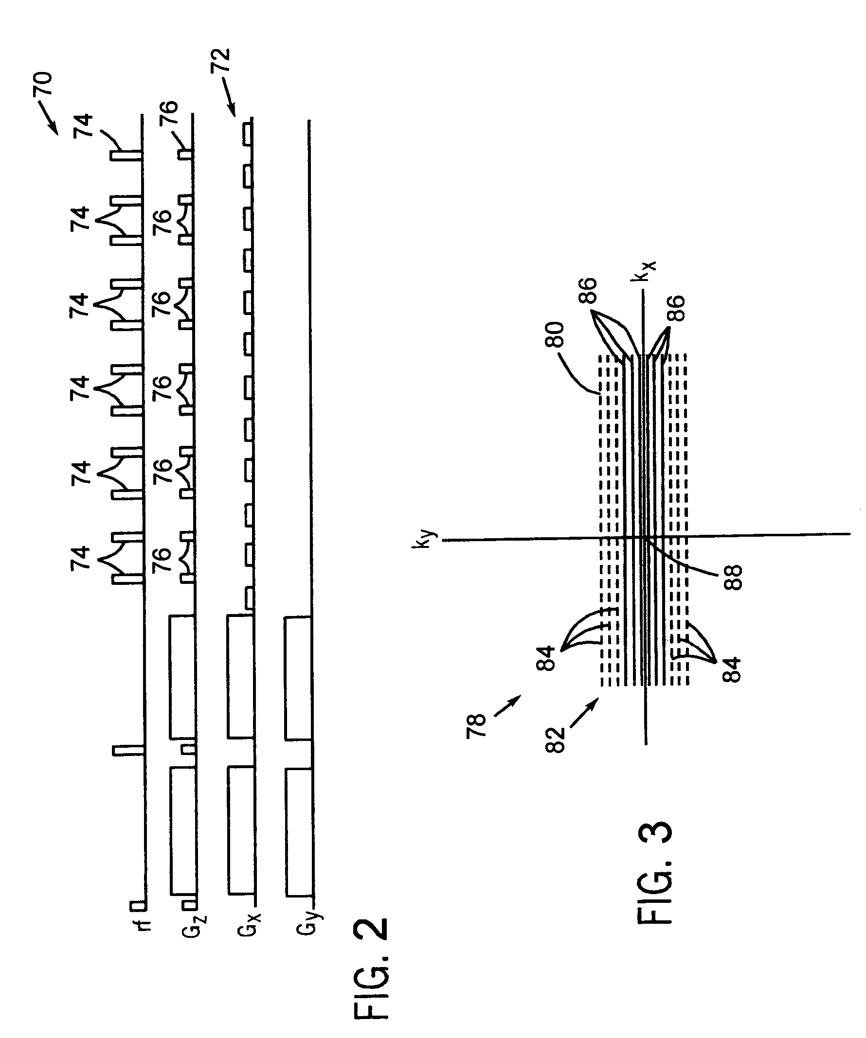 Method and system of determining in-plane motion in propeller data