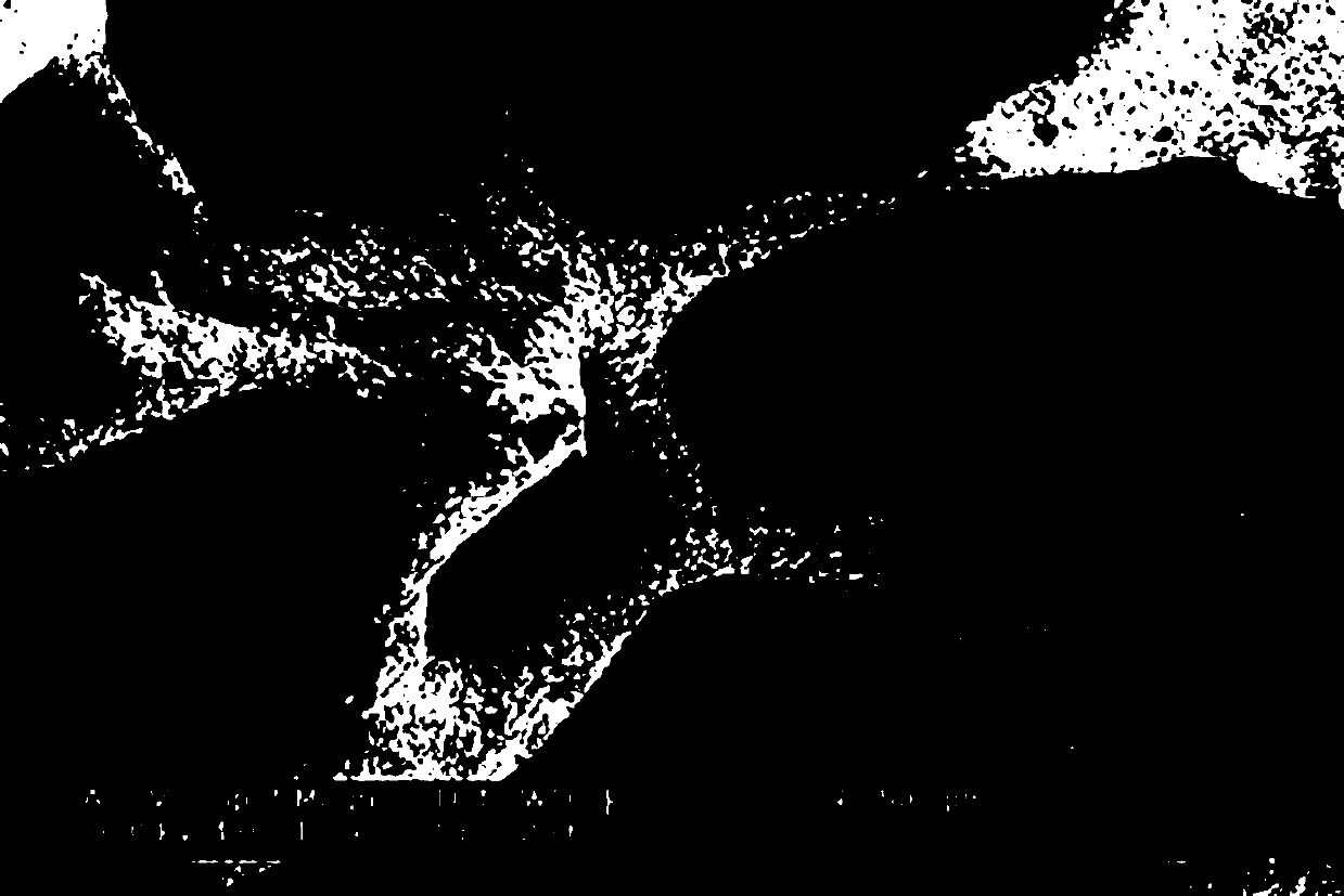 Cancellous bone structure simulating artificial bone having ultra-low elasticity modulus and preparation method of artificial bone