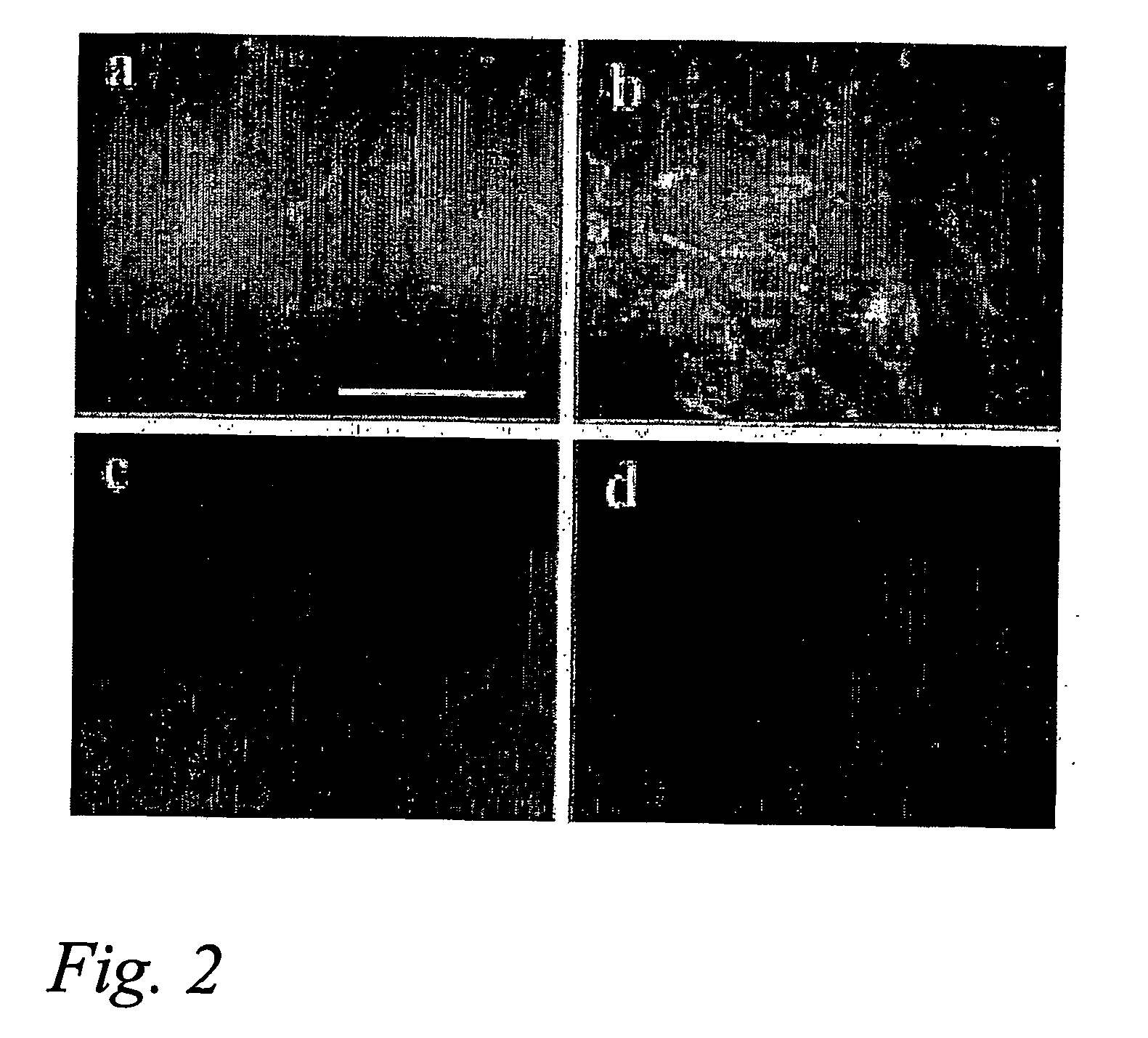 Elevation of adenosine level by cytokine-induced expression of cd73