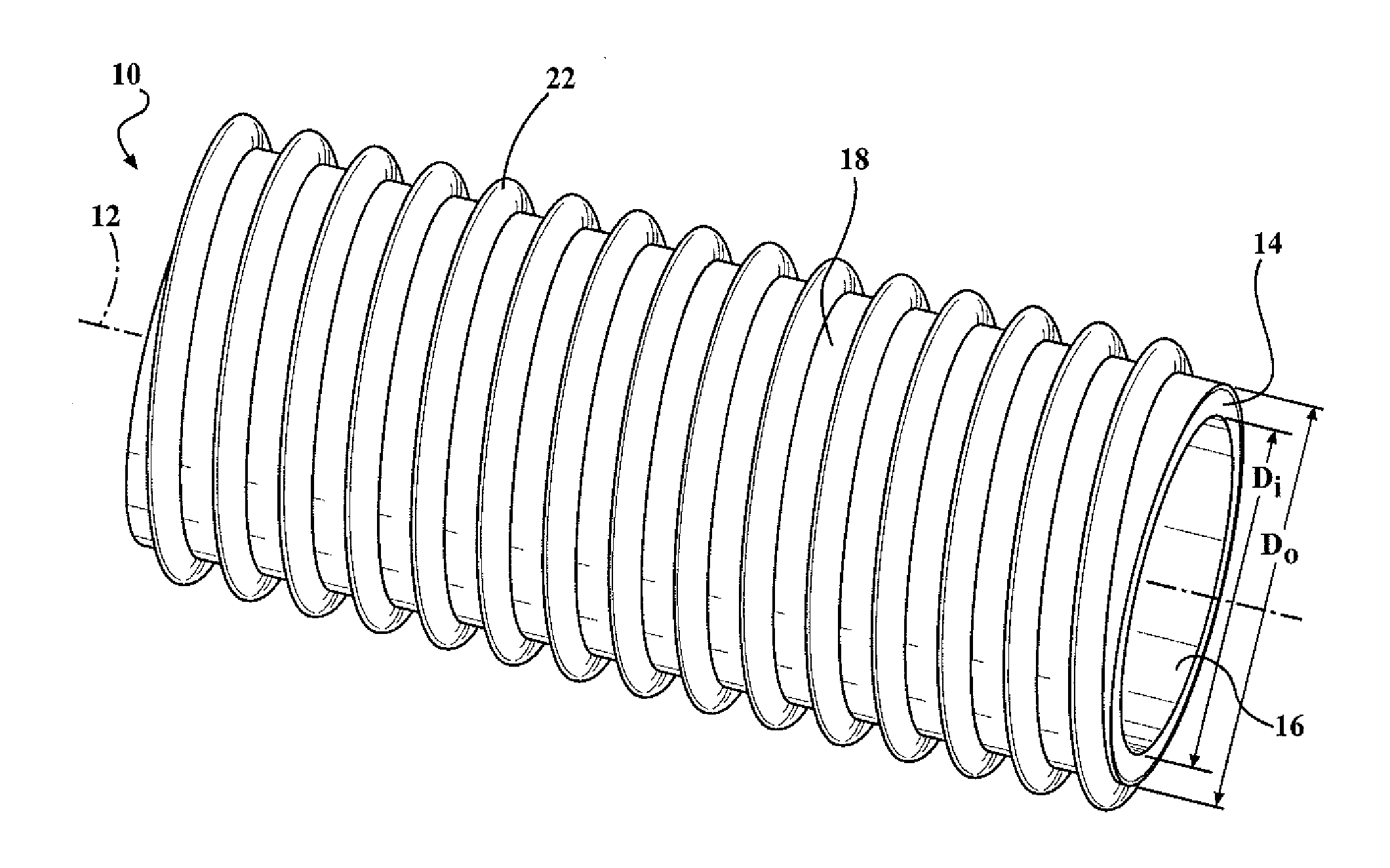 Reinforced hose assembly