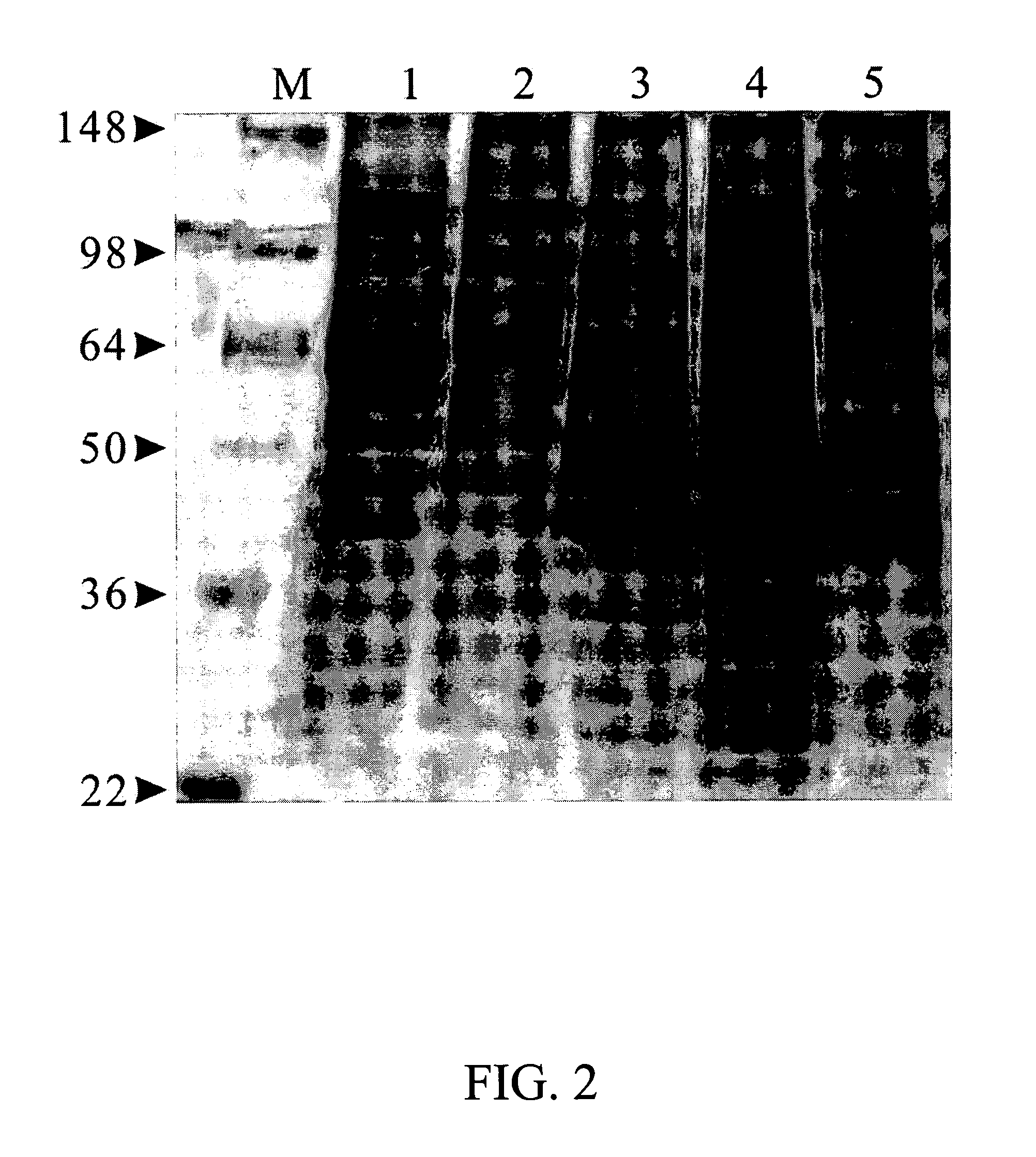 Microorganism strain of GM-020 of <i>Lactobacillus rhamnosus </i>and its use for treating obesity